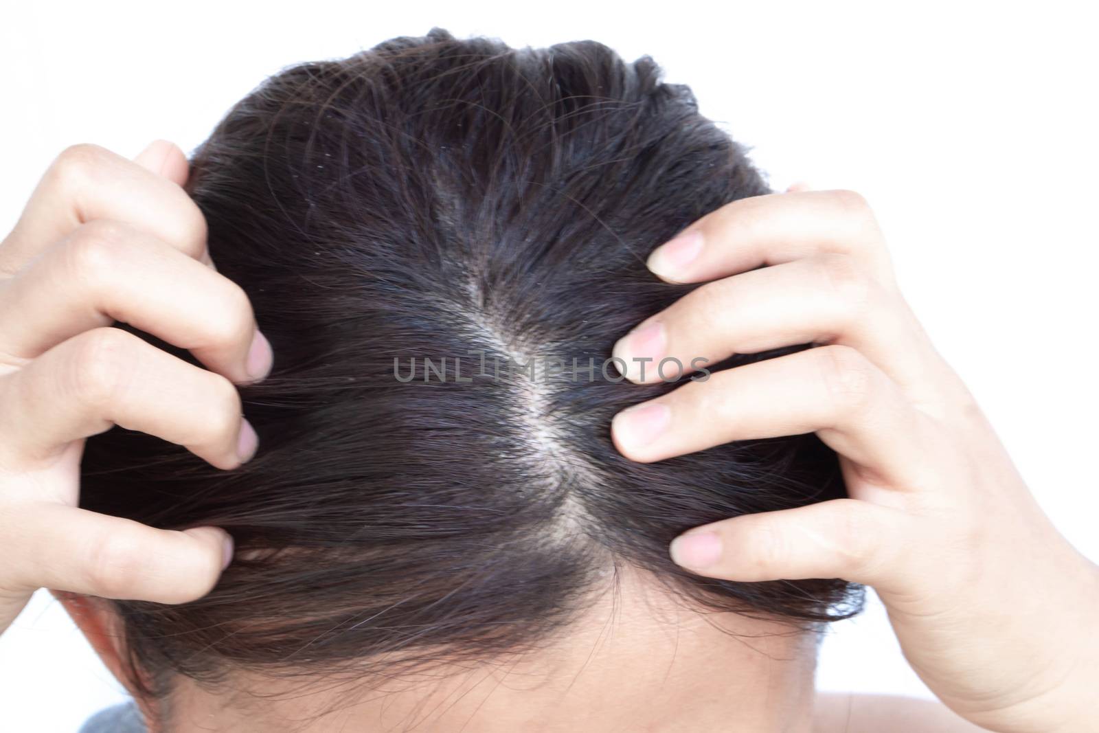 Closeup woman hand itchy scalp, Hair care concept