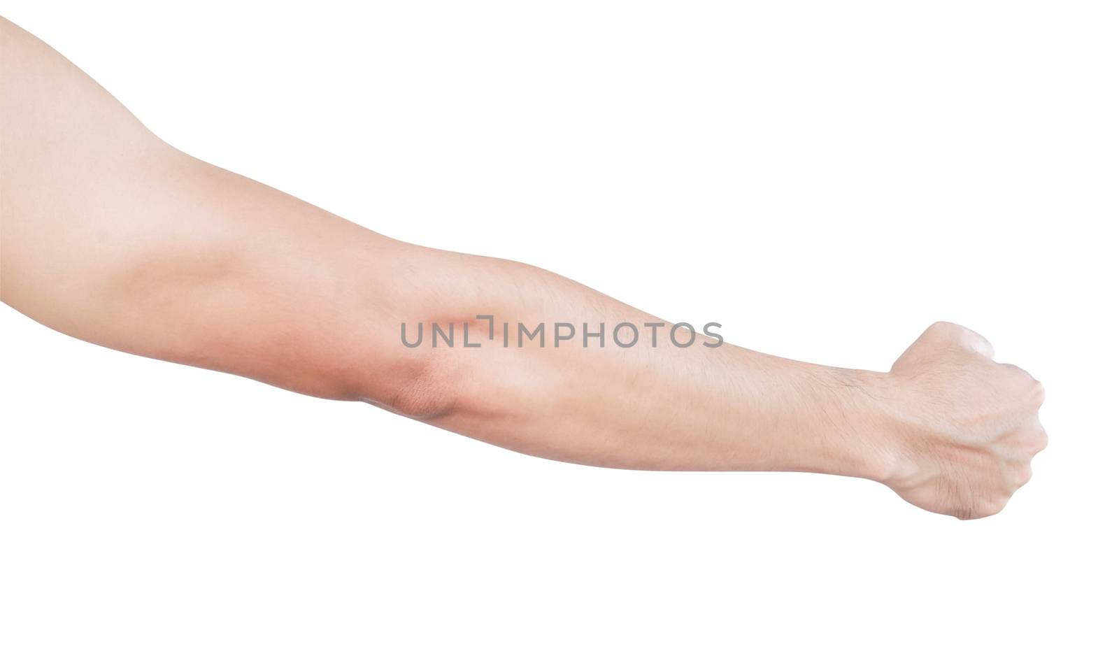 Man arm with blood veins on white background, health care and medical concept