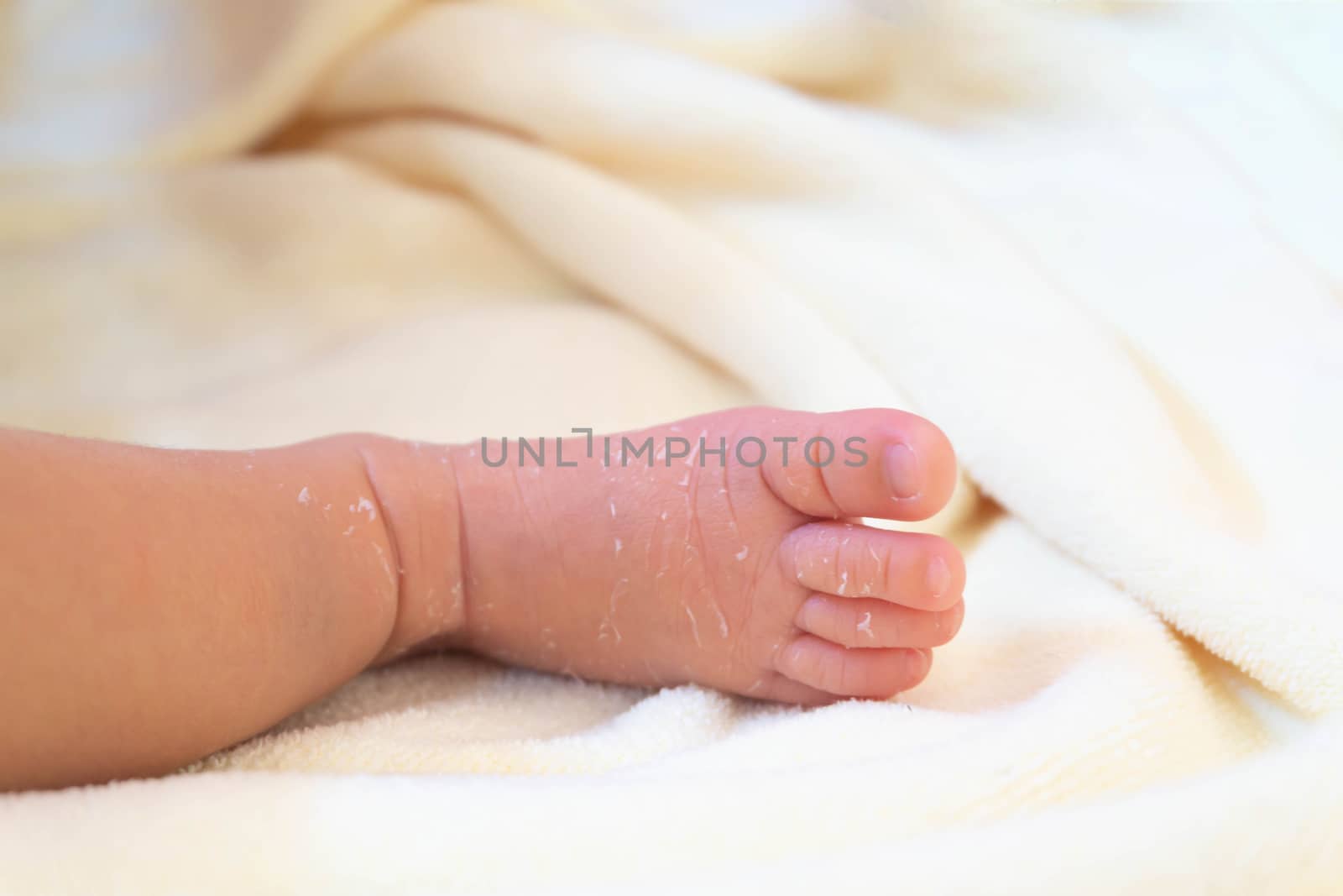 Closeup legs of newborn with peeling skin on white cloth, health by pt.pongsak@gmail.com