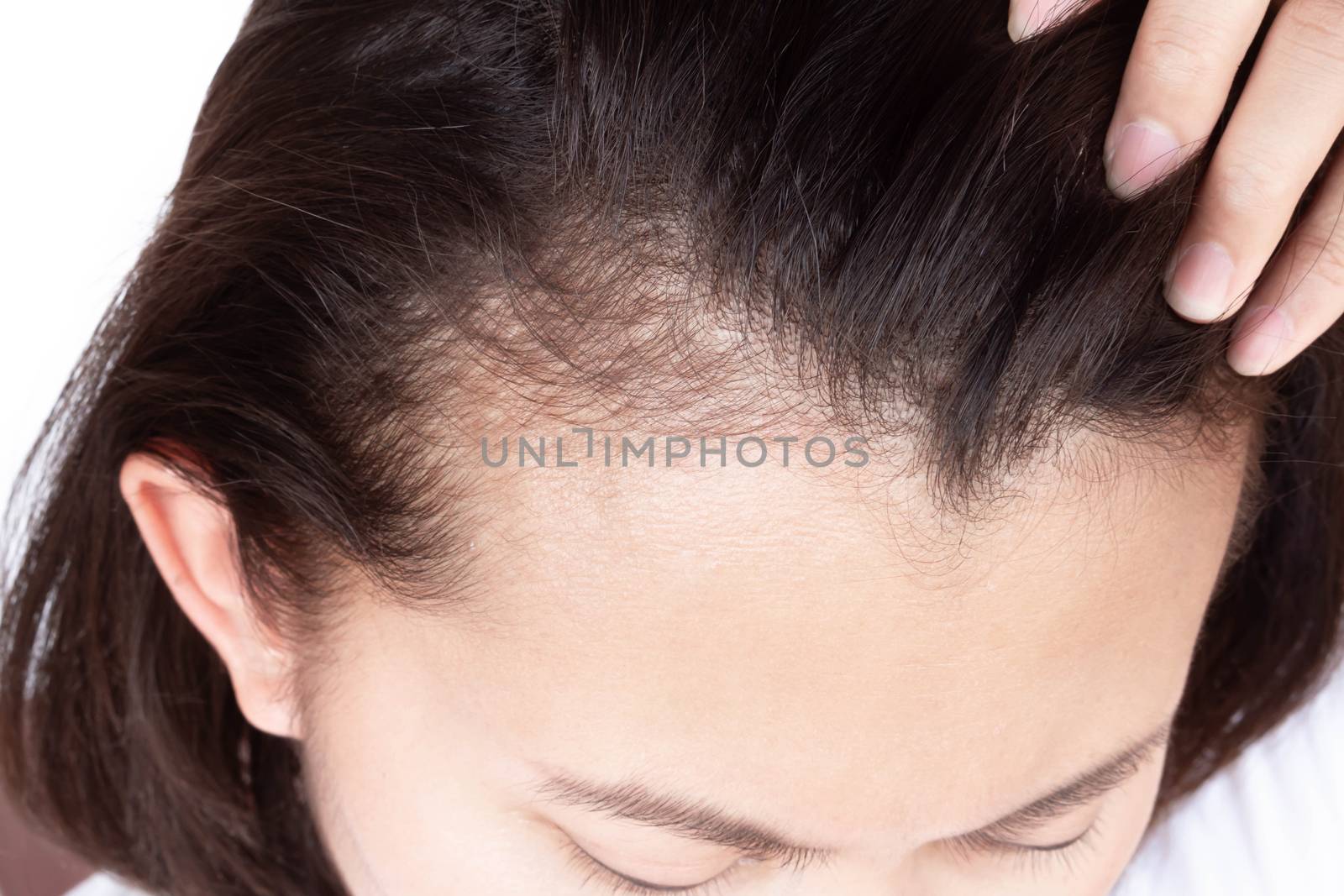 Woman serious hair loss problem for health care shampoo and beauty product concept, selective focus