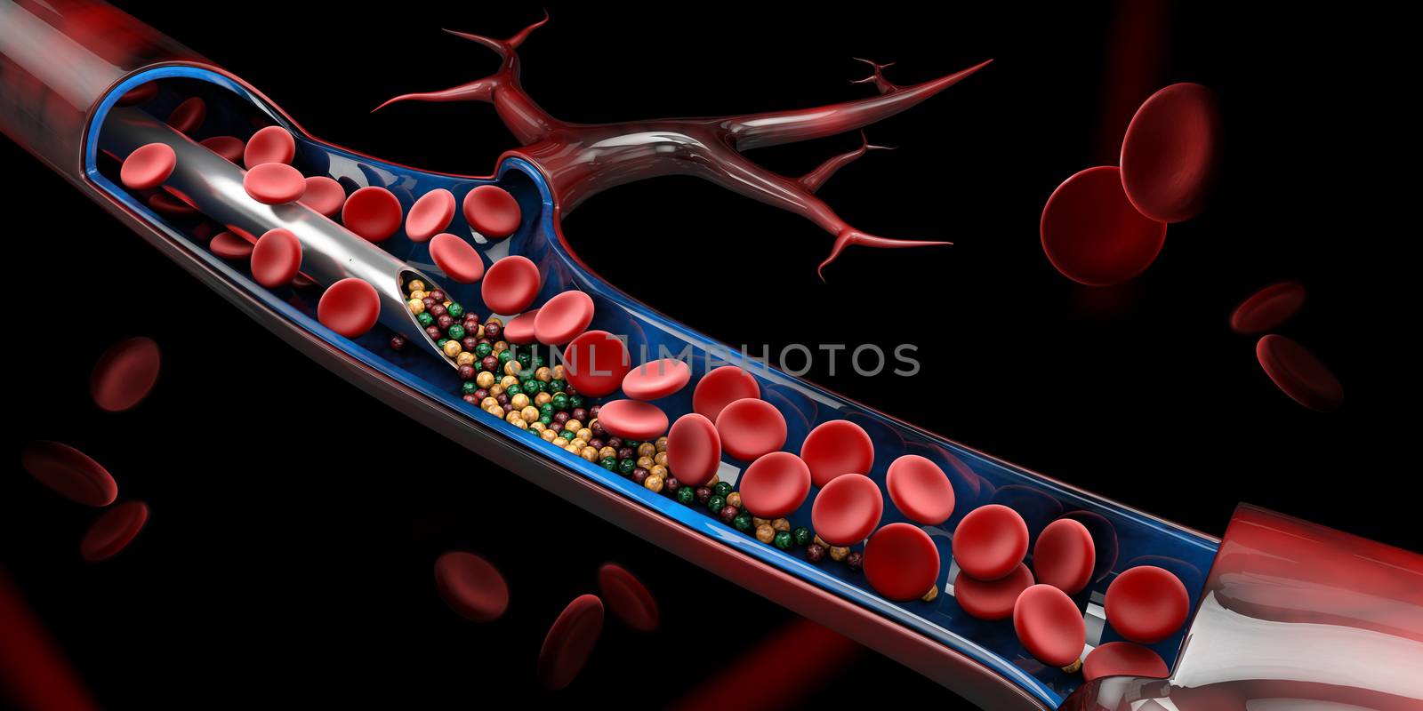 3d Illustration of Injection in the vein with vitamin.