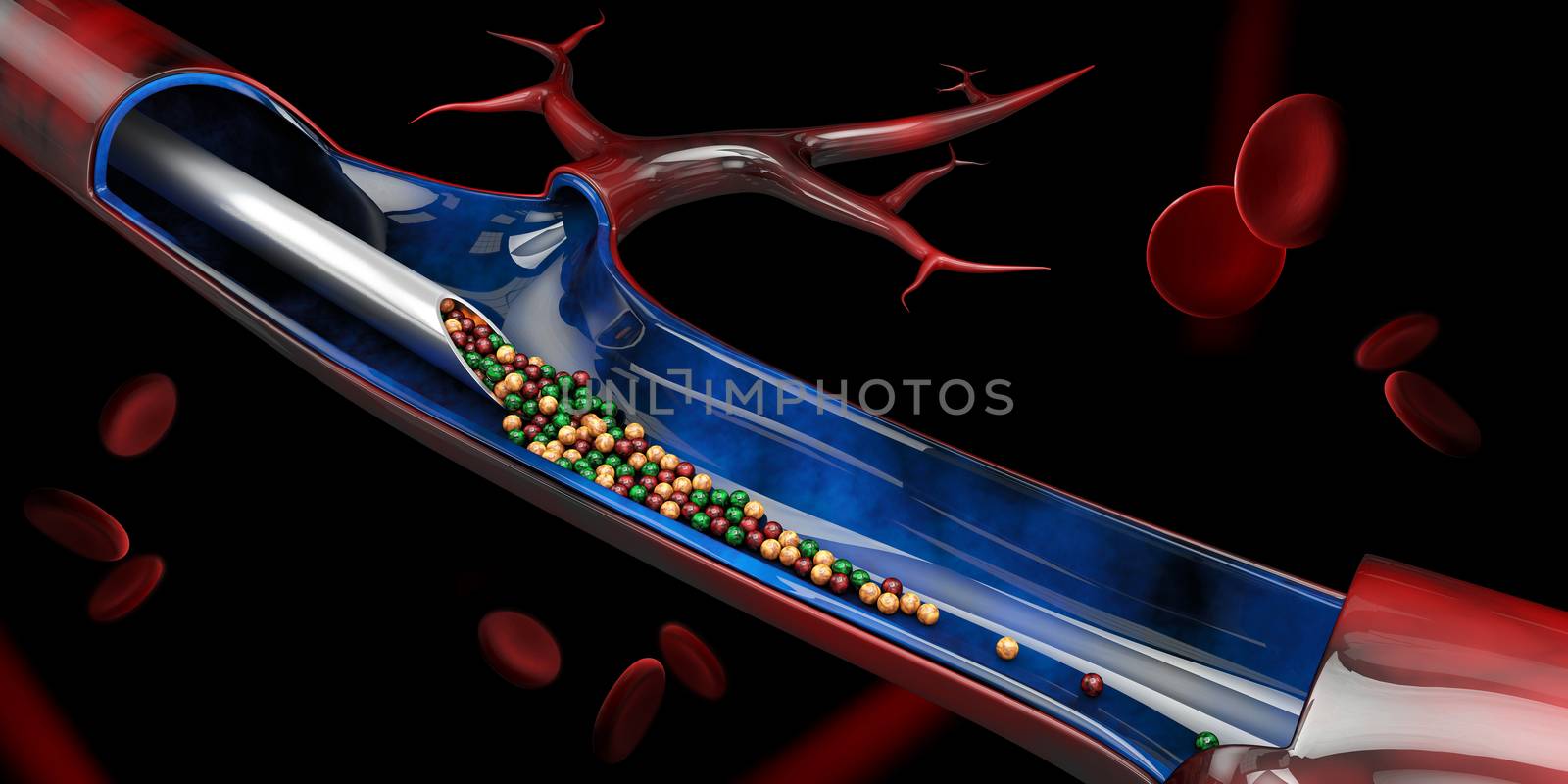 3d Illustration of Injection in the vein with vitamin