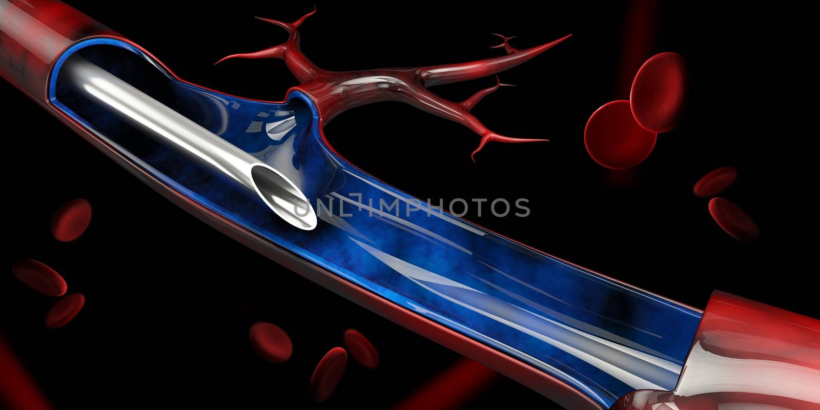 3d Illustration of Injection in the vein on black background.