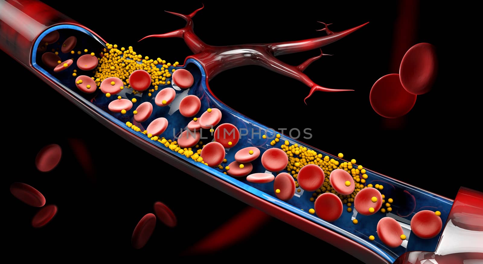 3d Illustration of blood cells with plaque buildup of cholesterol