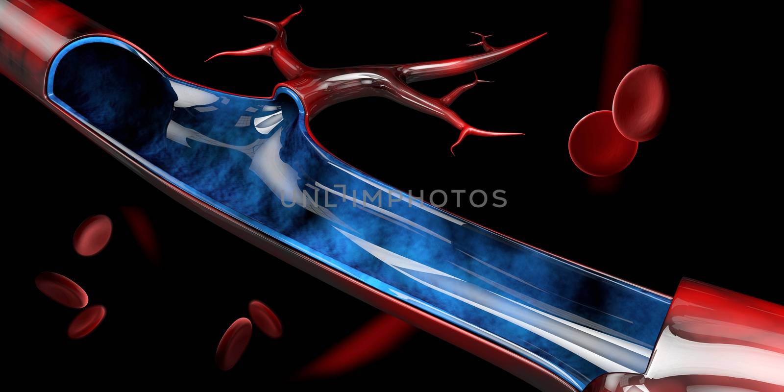 3d Illustration of blood vein with red blood cells.