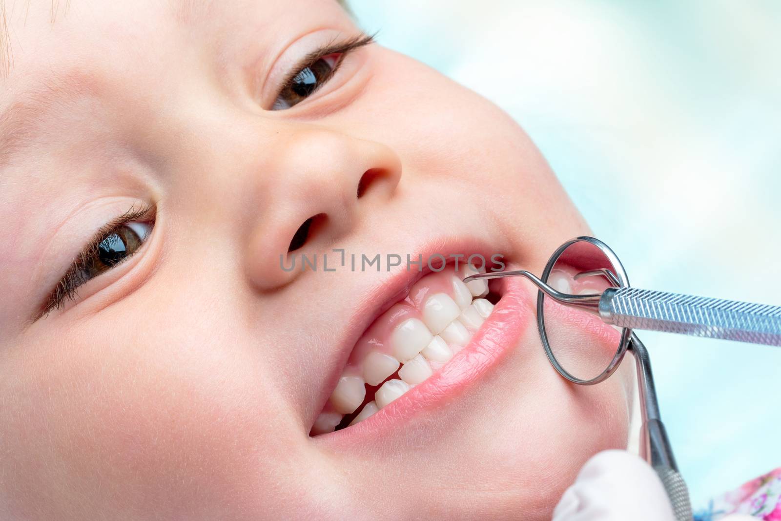 Macro close up of little life year old showing teeth at dental check up.Dentist hands holding mouth mirror and hatchet near teeth.