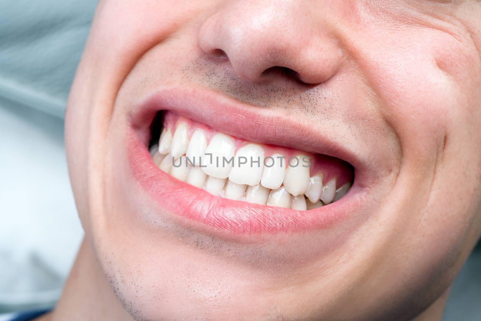 Macro close up of human male mouth showing perfect white teeth.