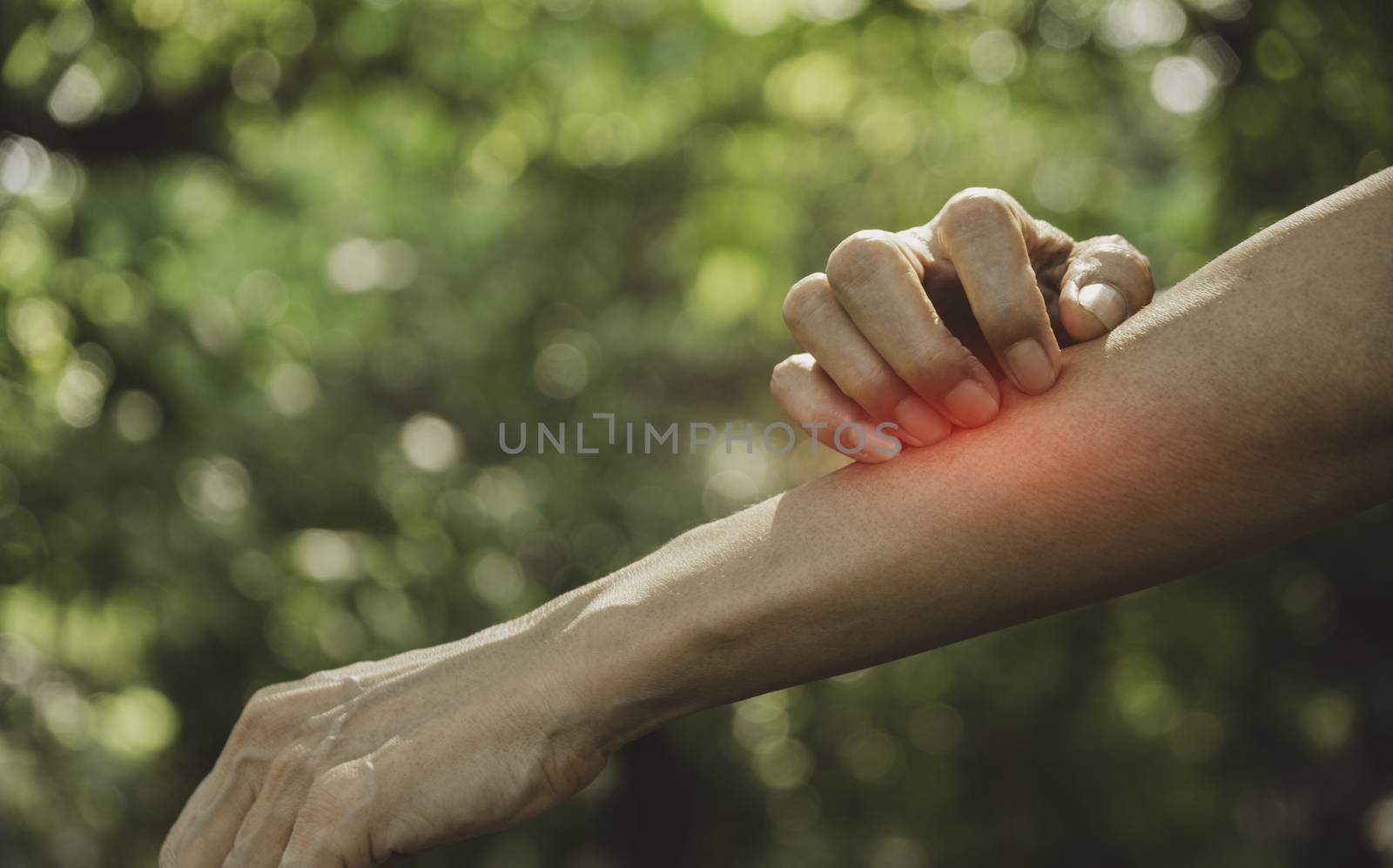 Man scratch itch with hand. Man scratching his hand healthcare concept.