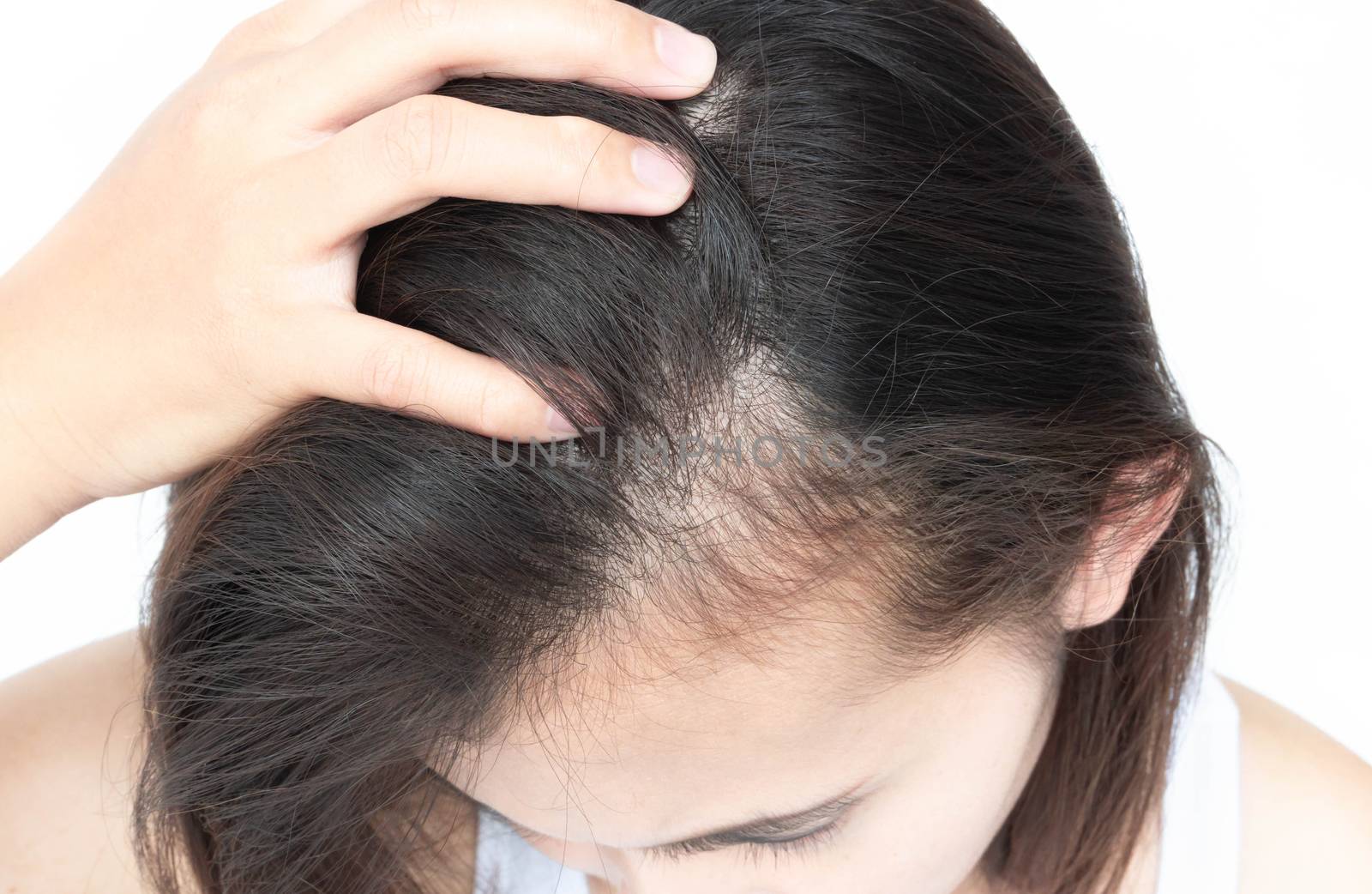 Woman serious hair loss problem for health care shampoo and beau by pt.pongsak@gmail.com