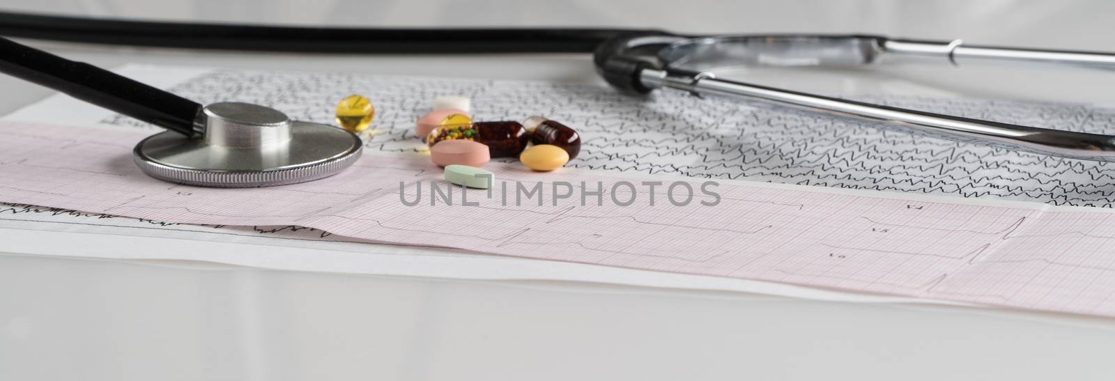 medical stethoscope with pills and cardiogram on a light background