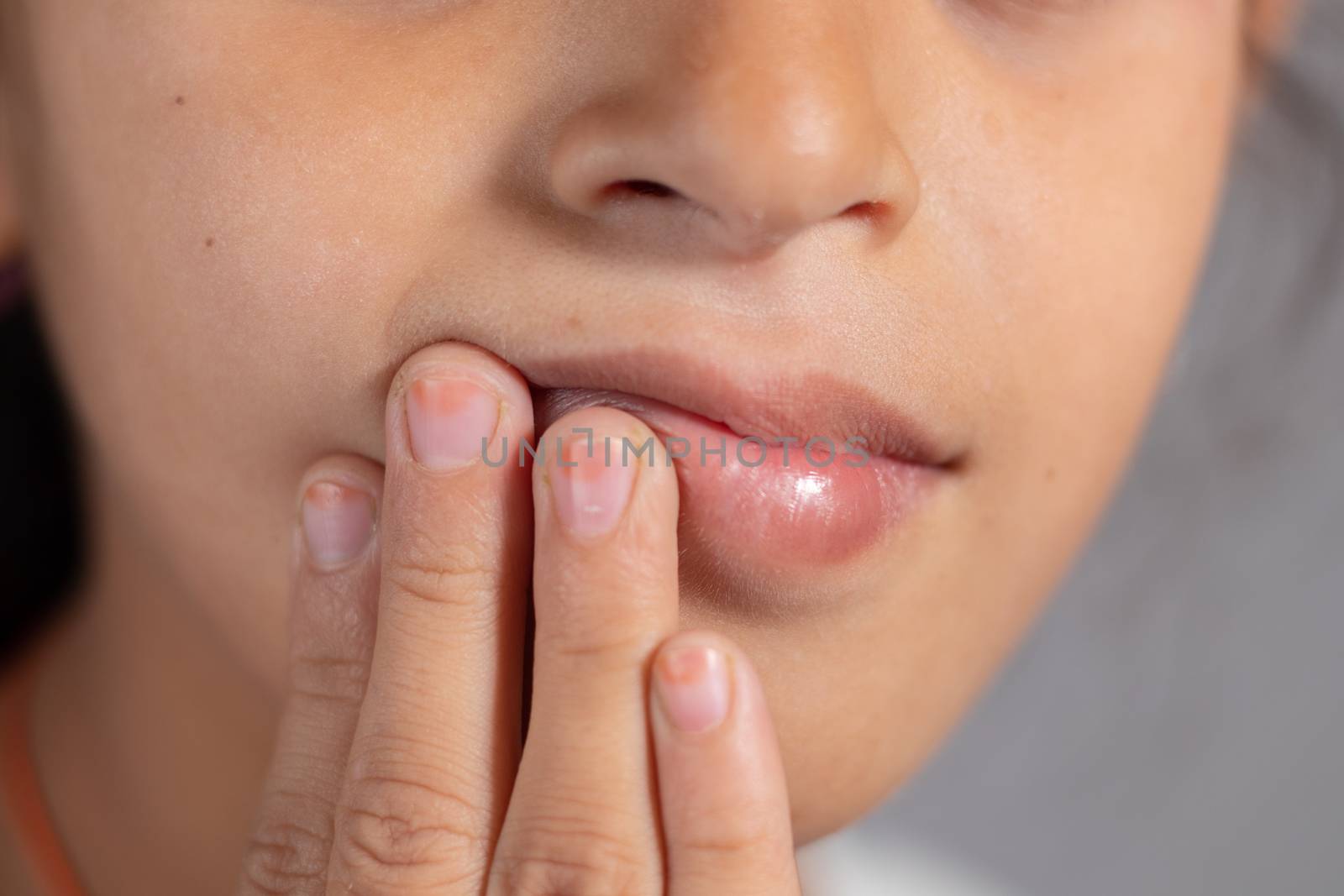 Extreme close up of child touch's her mouth - concept showing to prevent and Avoid touching your Mouth. Protect from COVID-19 or coronavirus spreading or outbreak - Don t Touch Your mouth