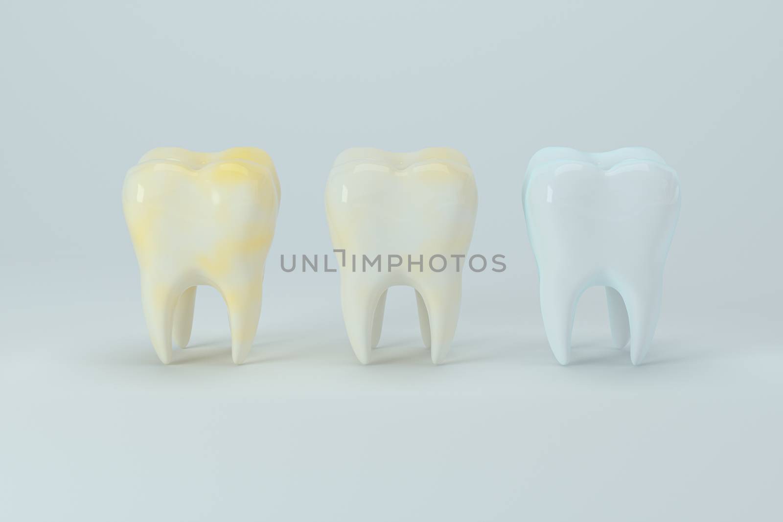 Changing of the tooth color from yellow to white, 3d rendering. Computer digital drawing.