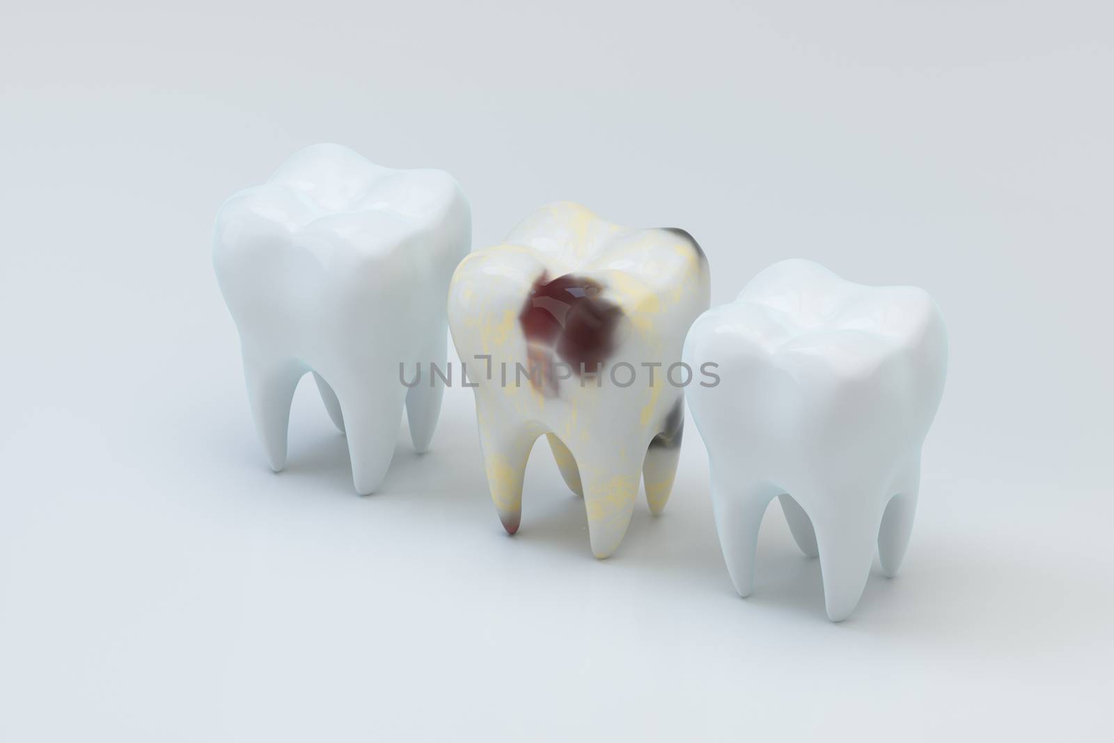 The decayed tooth beside with the white tooth, 3d rendering. by vinkfan