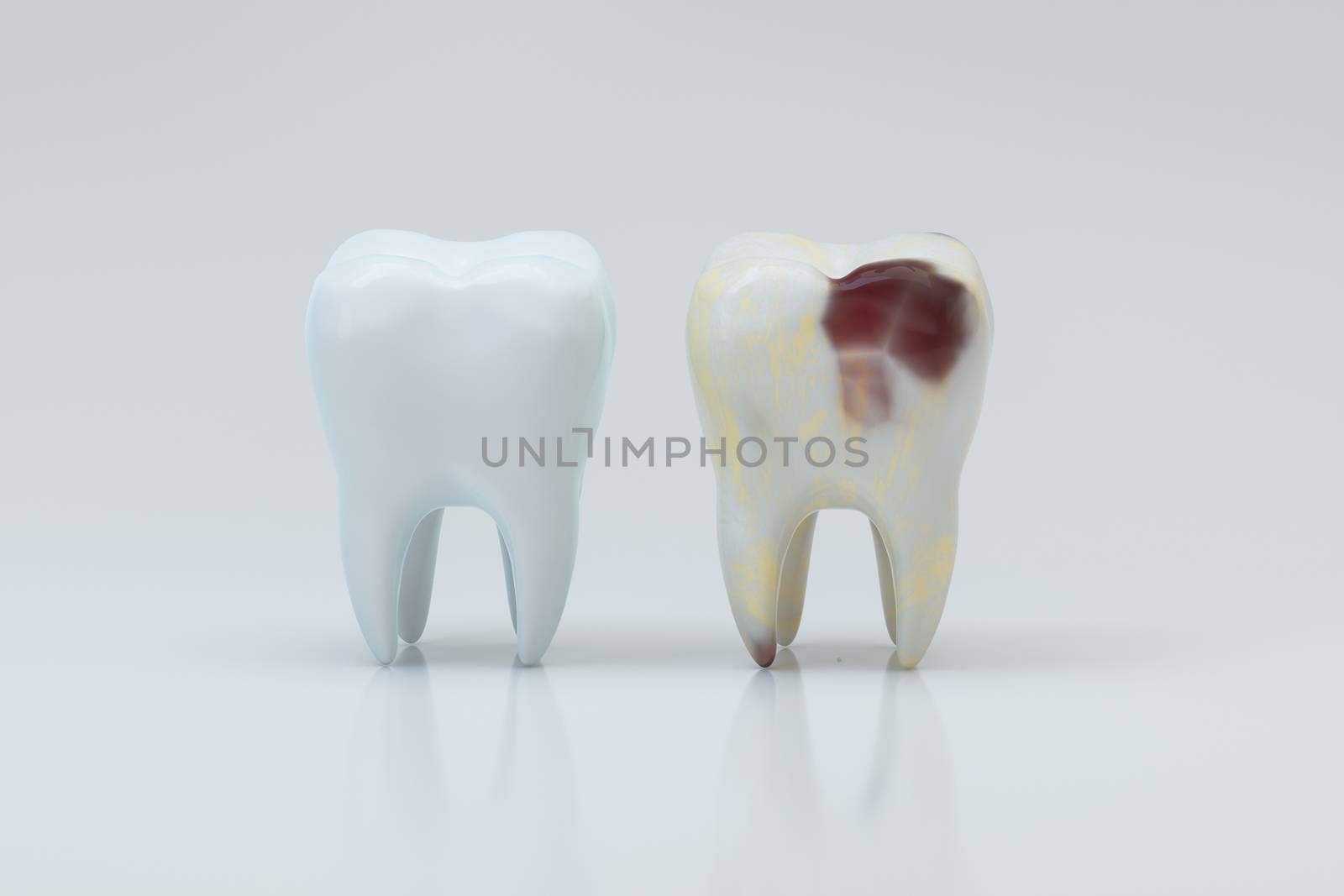 The decayed tooth beside with the white tooth, 3d rendering. by vinkfan