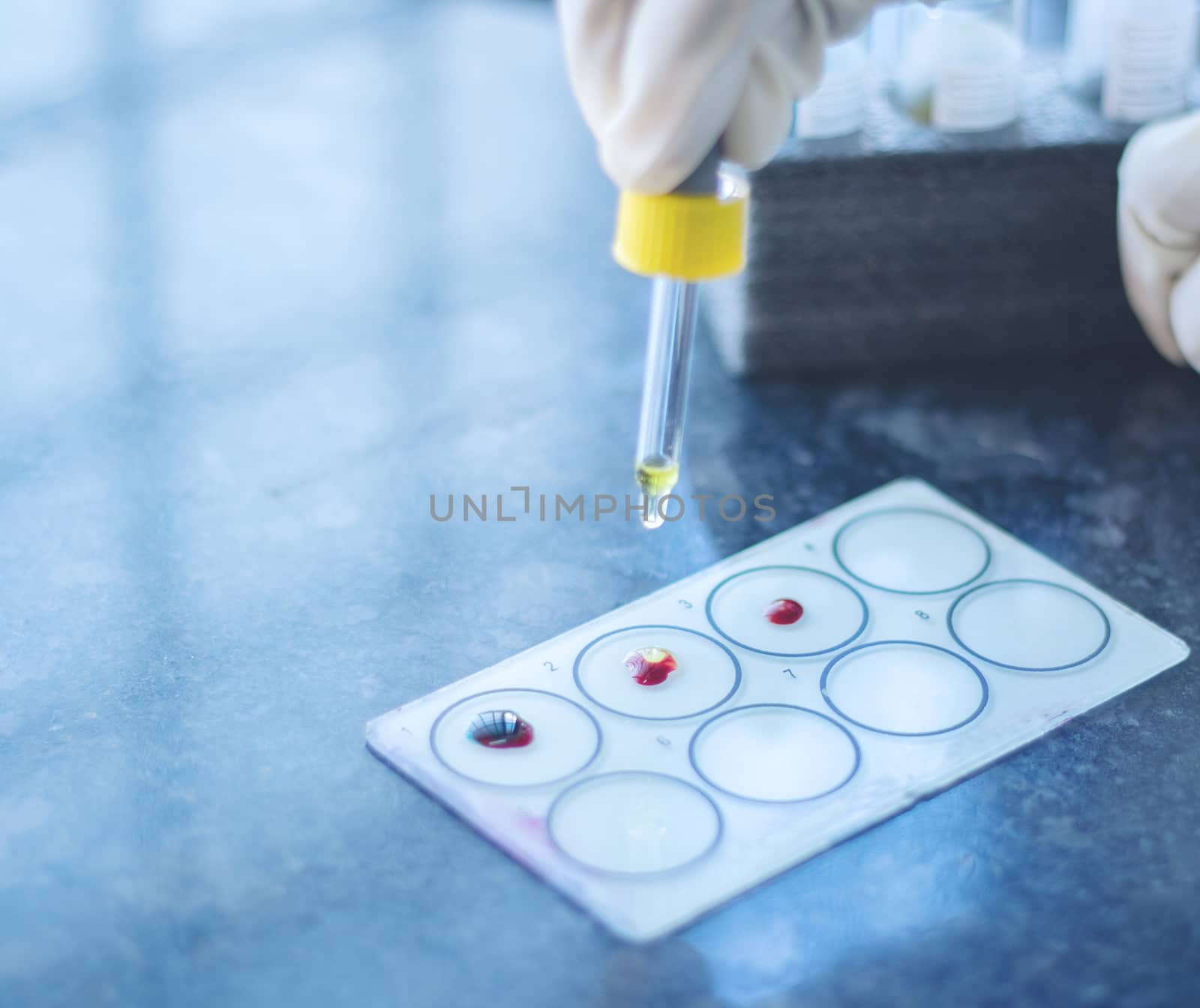 Close up, Hands testing Blood group called Protocol of ABO Blood grouping or testing, Adding Antisera to the blood drops on glass slide