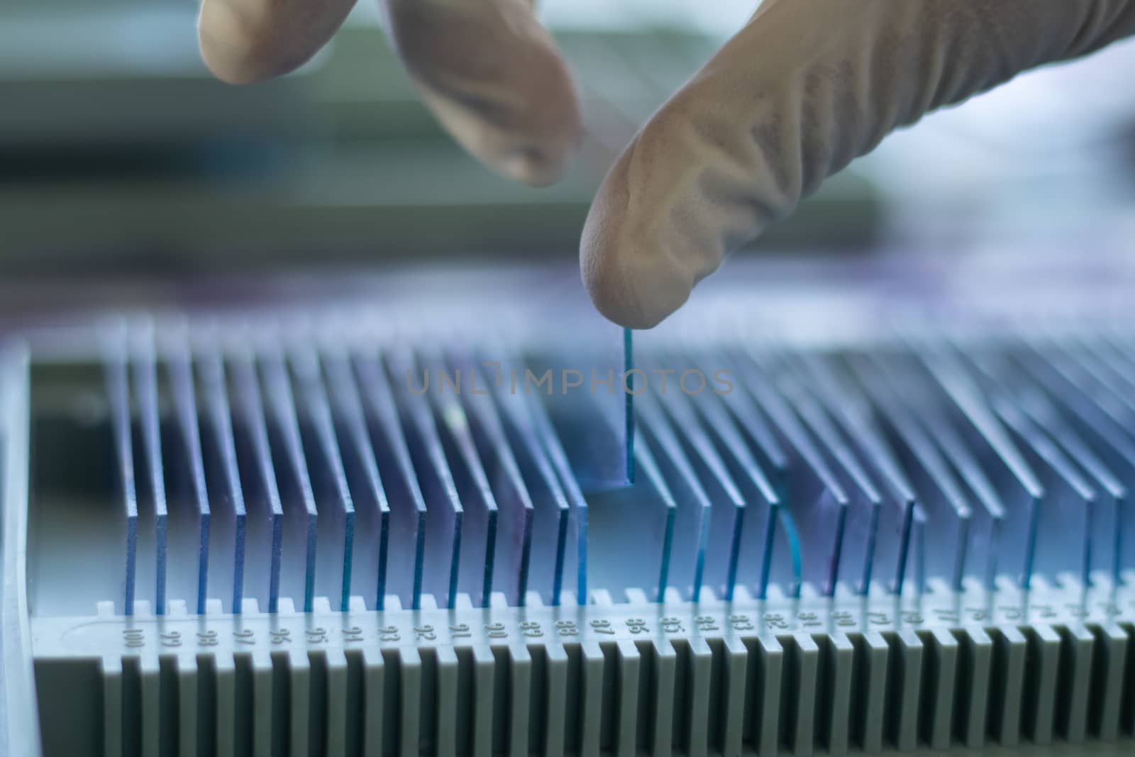 Closeup of hands checking Blood testing glass slide from the archive or old records at laboratory