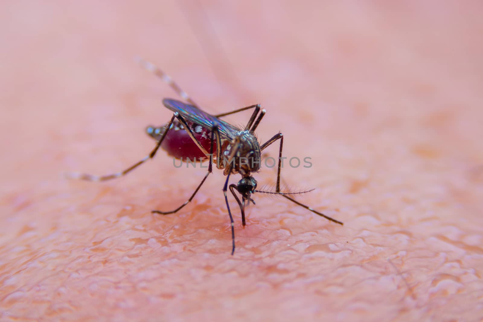 Striped mosquitoes are eating blood on human skin, Dangerous Malaria Infected Mosquito Skin Bite