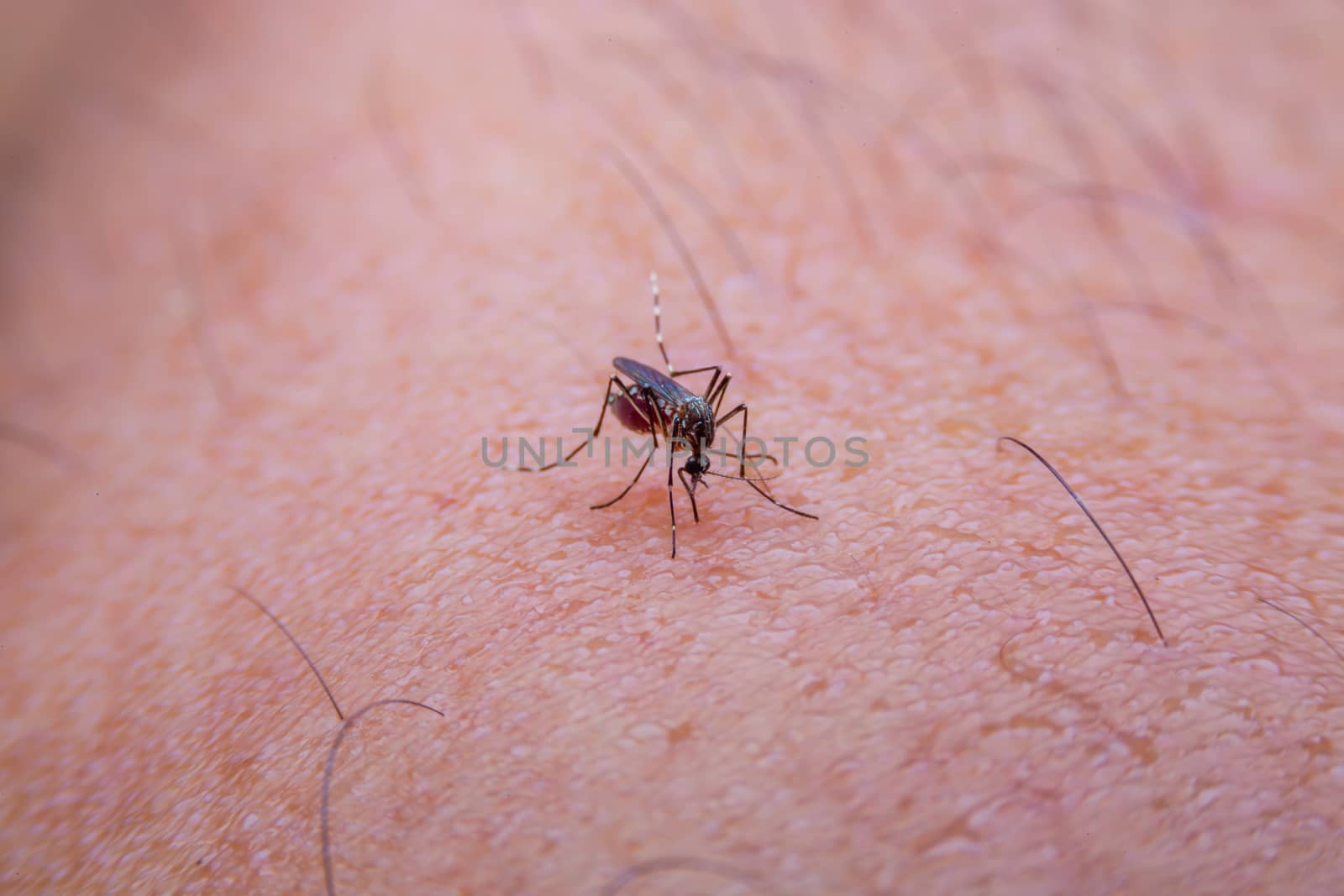 Striped mosquitoes are eating blood on human skin, Dangerous Malaria Infected Mosquito Skin Bite