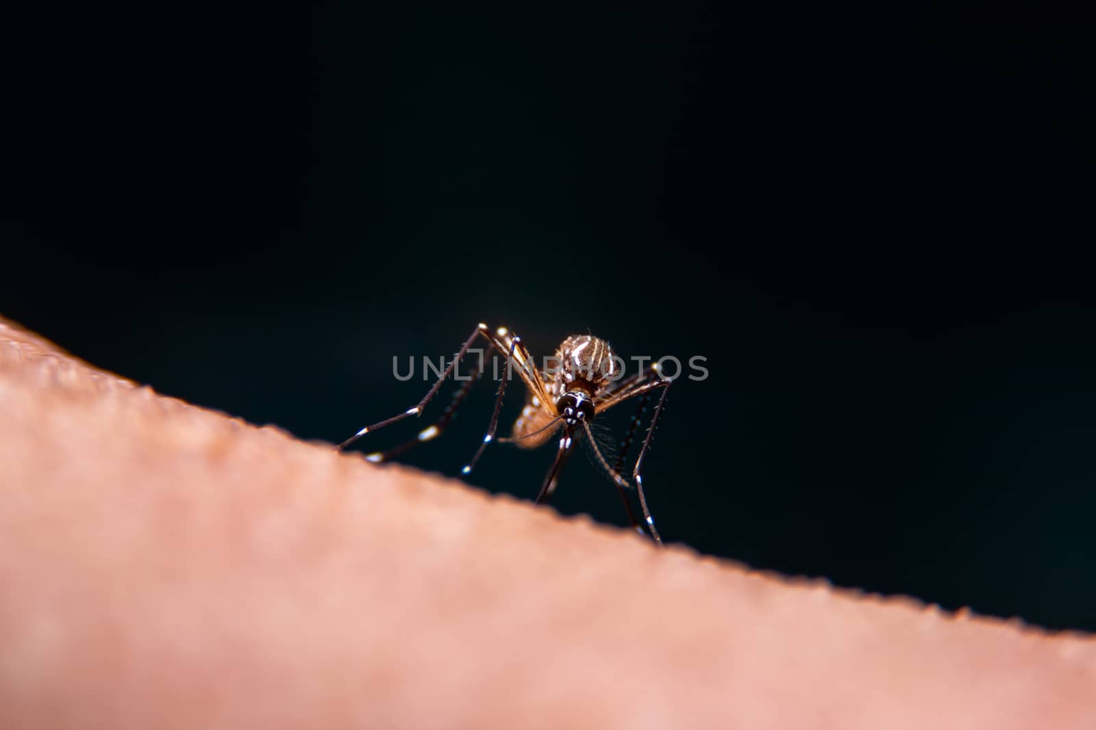 Striped mosquitoes are eating blood on human skin, Dangerous Malaria Infected Mosquito Skin Bite