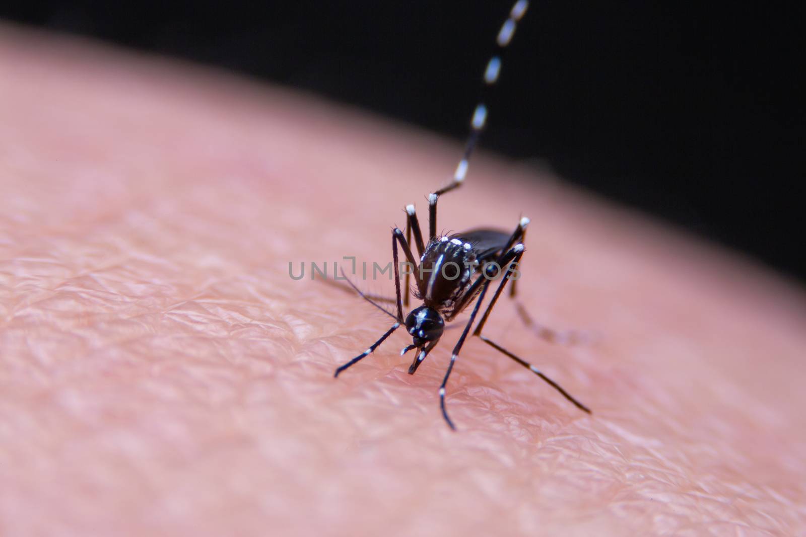 Striped mosquitoes are eating blood on human skin, Dangerous Malaria Infected Mosquito Skin Bite