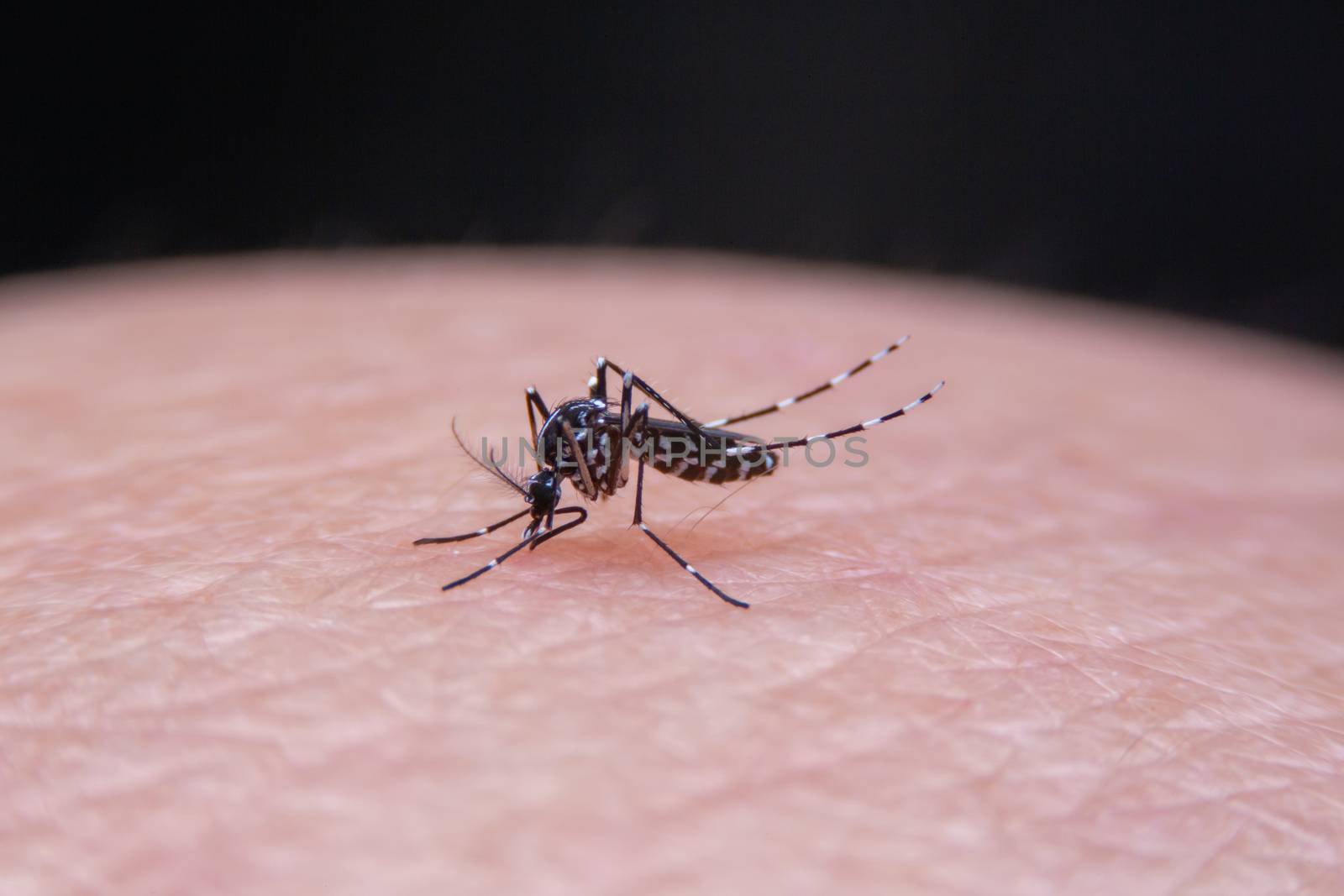 Striped mosquitoes are eating blood on human skin, Dangerous Malaria Infected Mosquito Skin Bite