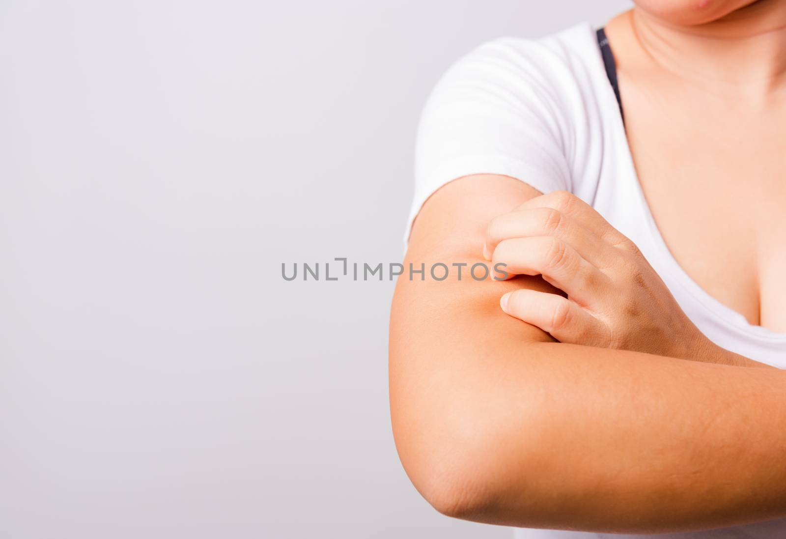 Asian beautiful woman itching her useing hand scratch itch Arm on white background with copy space, Medical and Healthcare concept