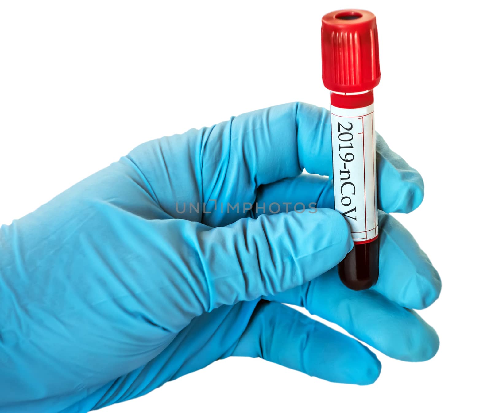 Coronavirus 2019-nCoV Blood Sample Test Tube biochemical by Vladyslav