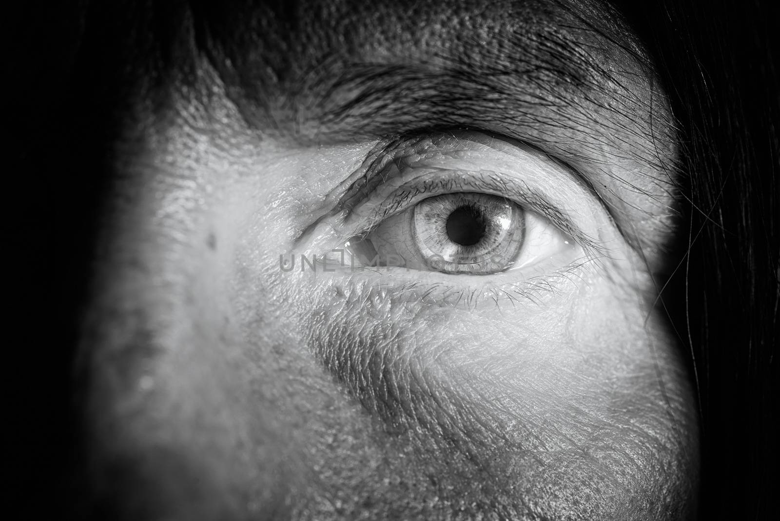 Close up of a woman's blue eye with a hard contact lens