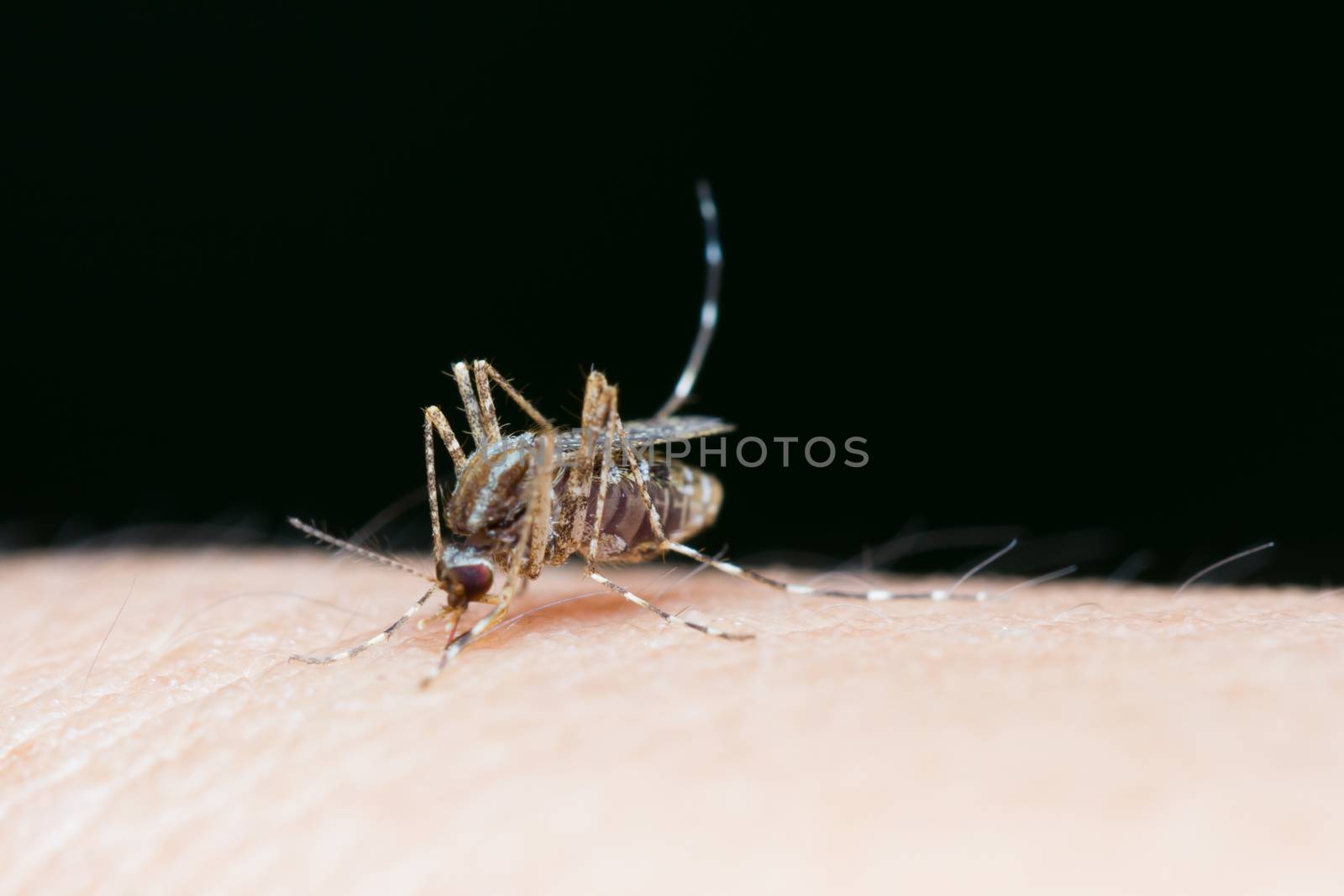 Striped mosquitoes are eating blood on human skin, Dangerous Malaria Infected Mosquito Skin Bite