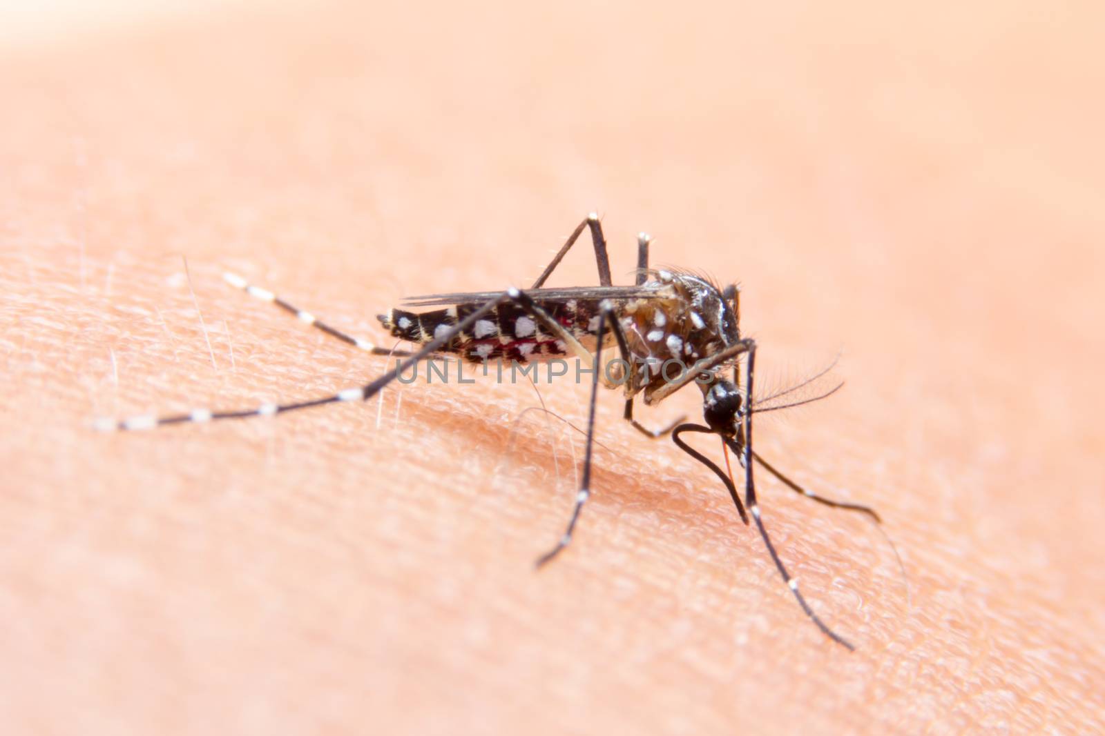 Striped mosquitoes are eating blood on human skin, Dangerous Malaria Infected Mosquito Skin Bite