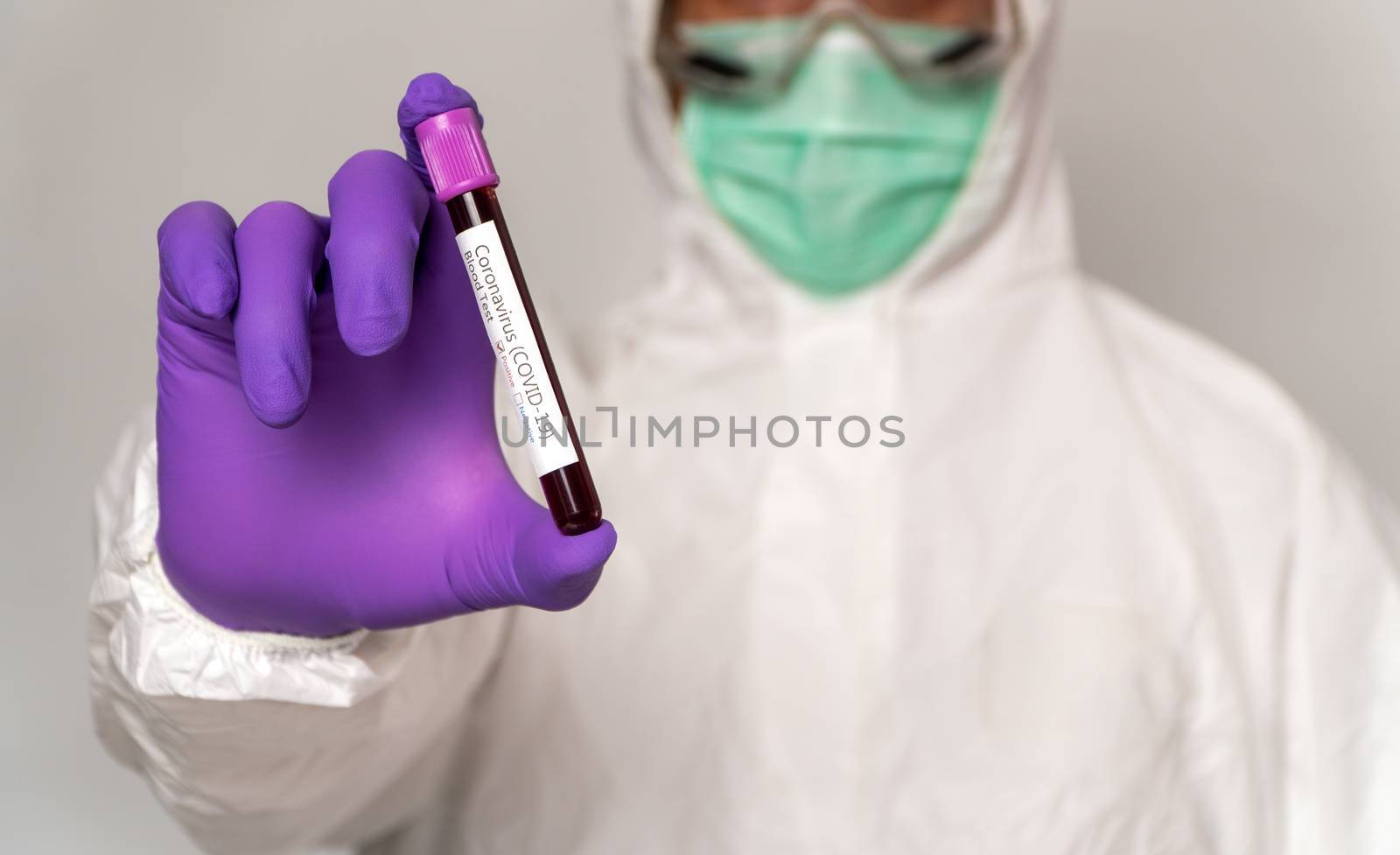 Doctors in the protective suits and masks are holding a positive blood test result for new rapidly outbreaking Coronavirus. Concept of spreading Coronavirus (COVID-19) around the world, USA, Europe by PattyPhoto