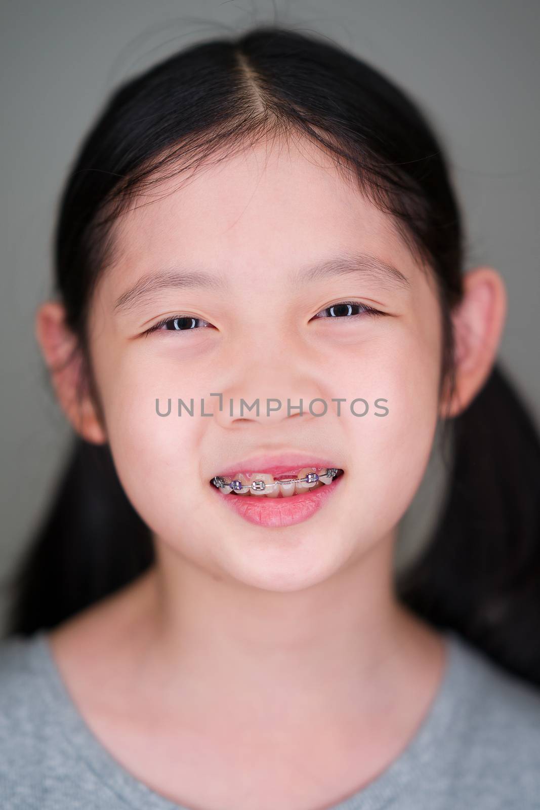 Smiling Asian Girl with Dental Braces