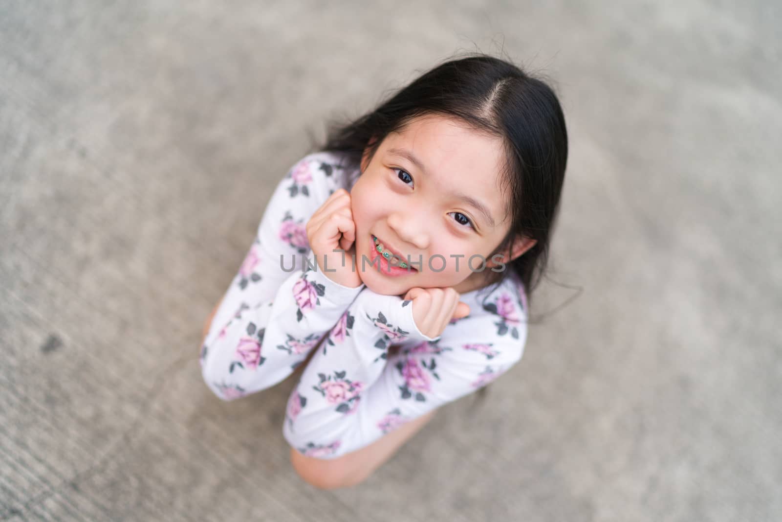 Braces on teeth of young Asian child.