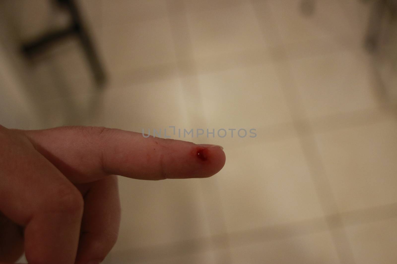 Bleeding blood from the cut finger wound. Injured finger with bleeding open cut wound. Closeup of finger human hand is cut hurt bleeding with bright red blood.. by mynewturtle1