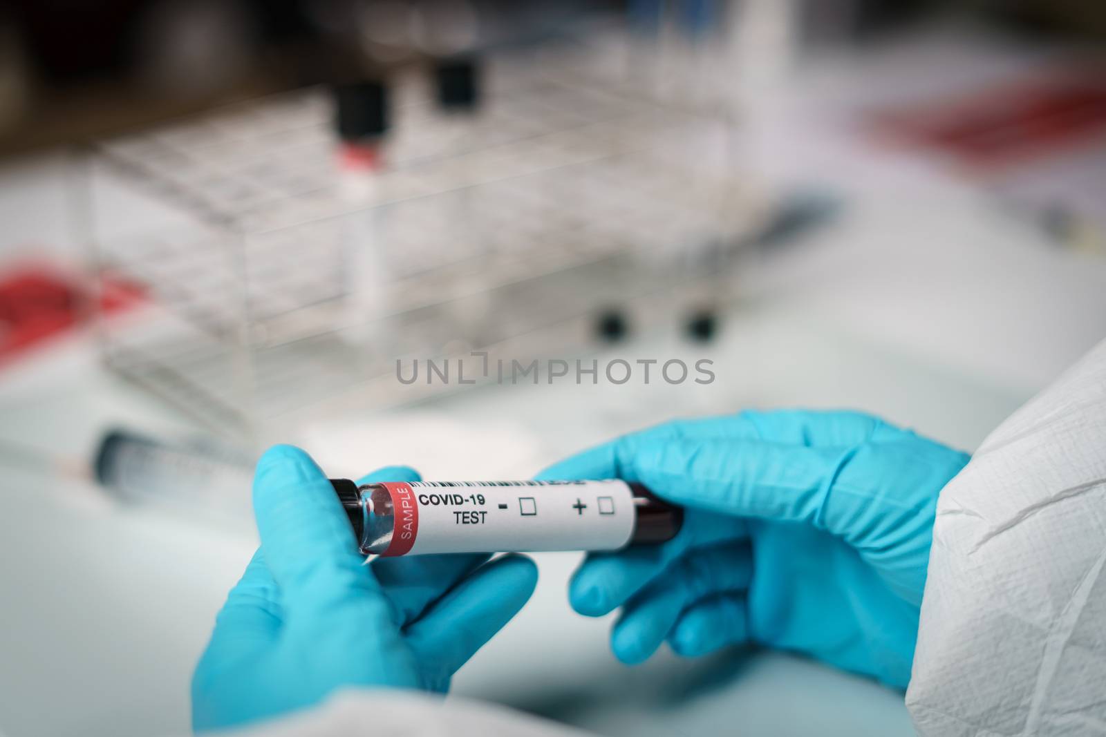 Coronavirus testing, a hand holds tube of blood test samples of by sirawit99