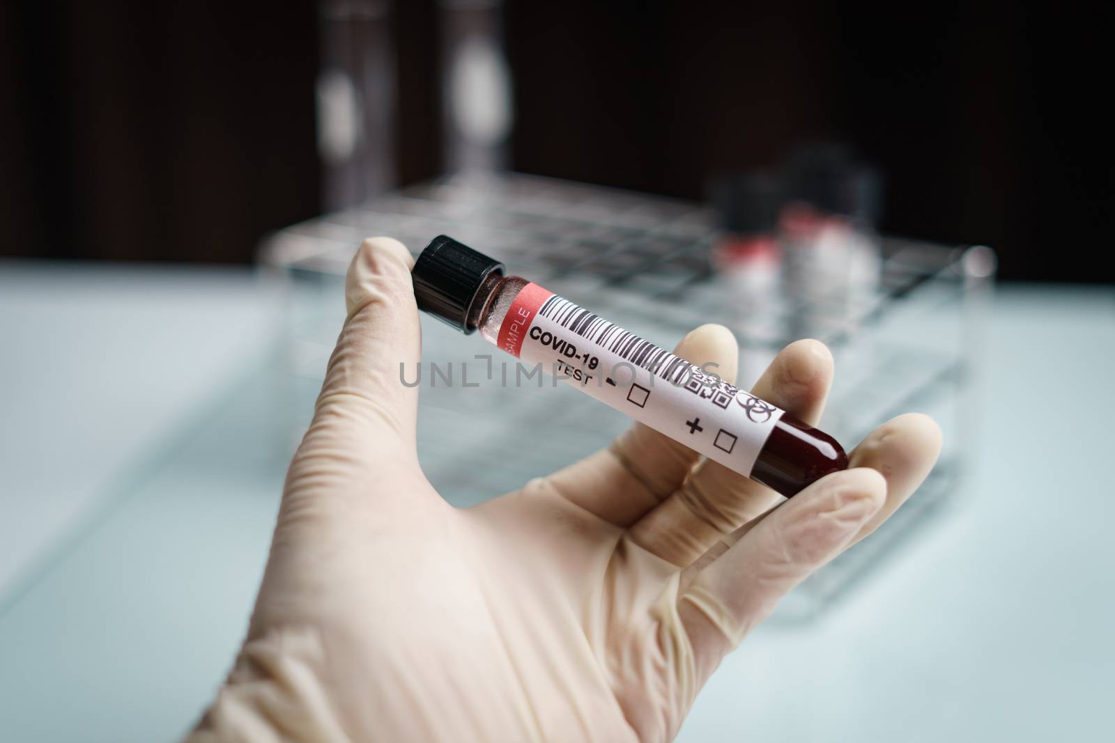 Coronavirus testing, a hand holds tube of blood test samples of coronavirus (COVID-19). (FAKE QR codes/barcodes)