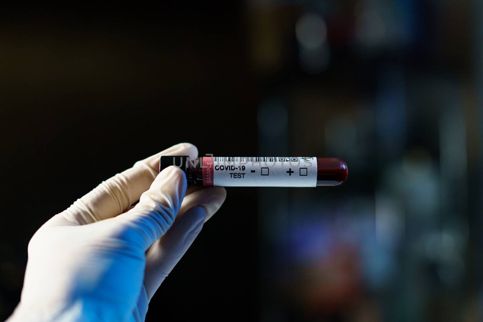 Coronavirus testing, a hand holds tube of blood test samples of coronavirus (COVID-19).