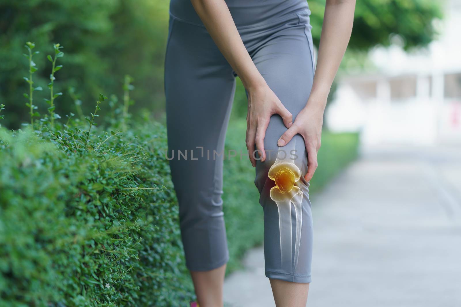 Woman holds her hands to the knee, pain in the knee highlighted by sirawit99