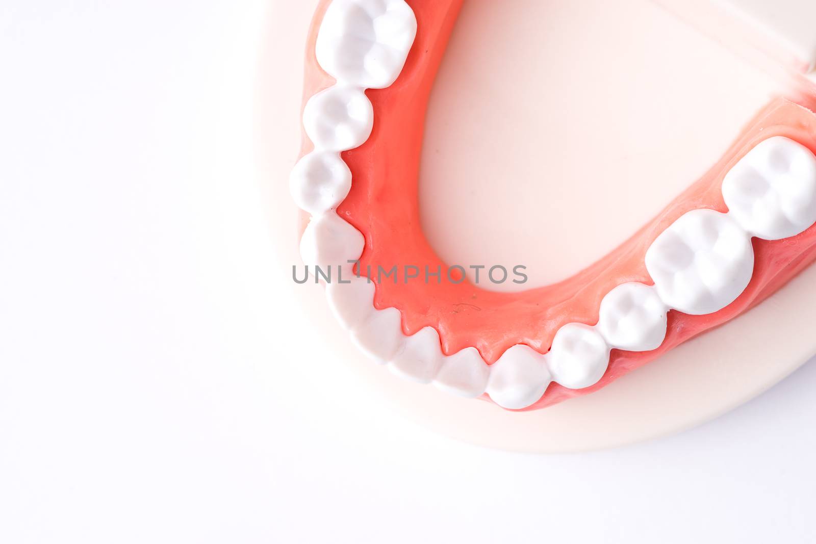 Set of Dentist's equipment tools, denture showing implant by Alicephoto