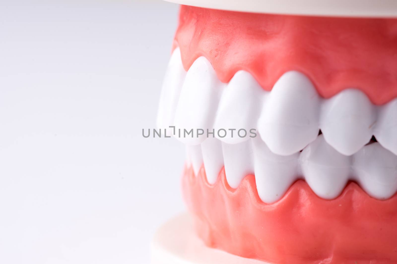Set of Dentist's equipment tools, denture showing implant by Alicephoto