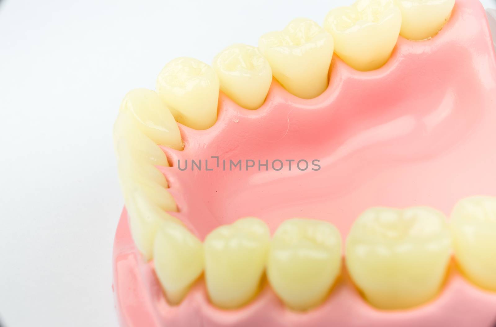 Denture for dental concept on white background by Alicephoto