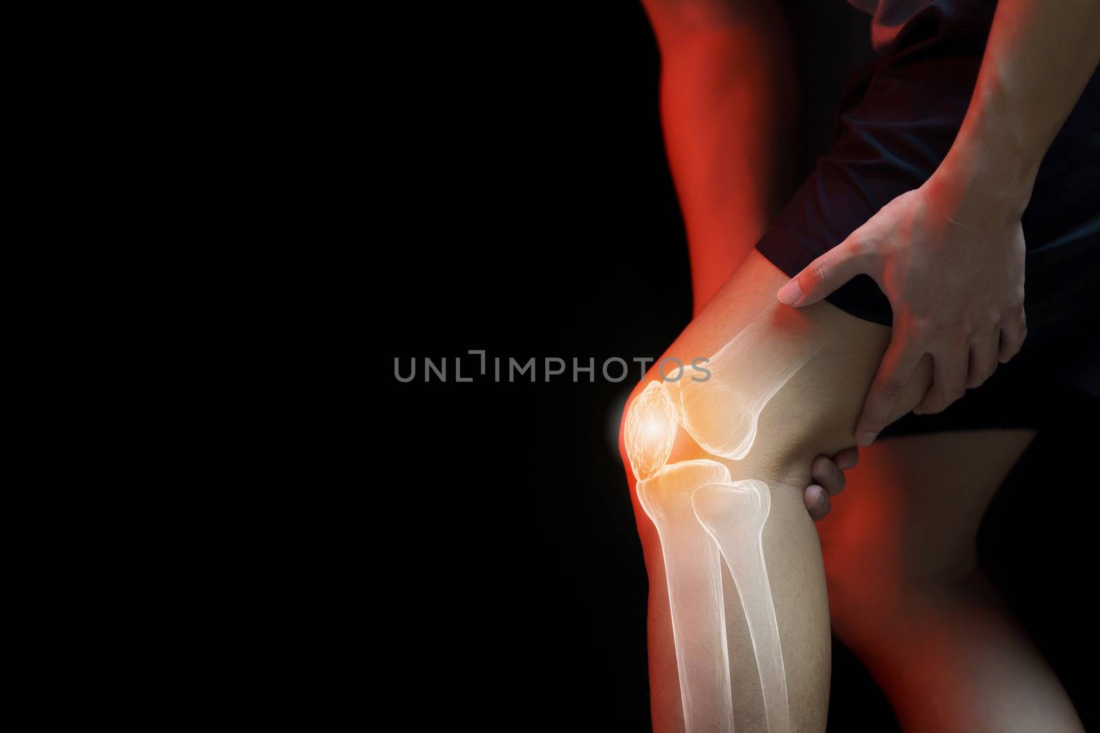Medical concept, man suffering with knee painful - skeleton x-ray,