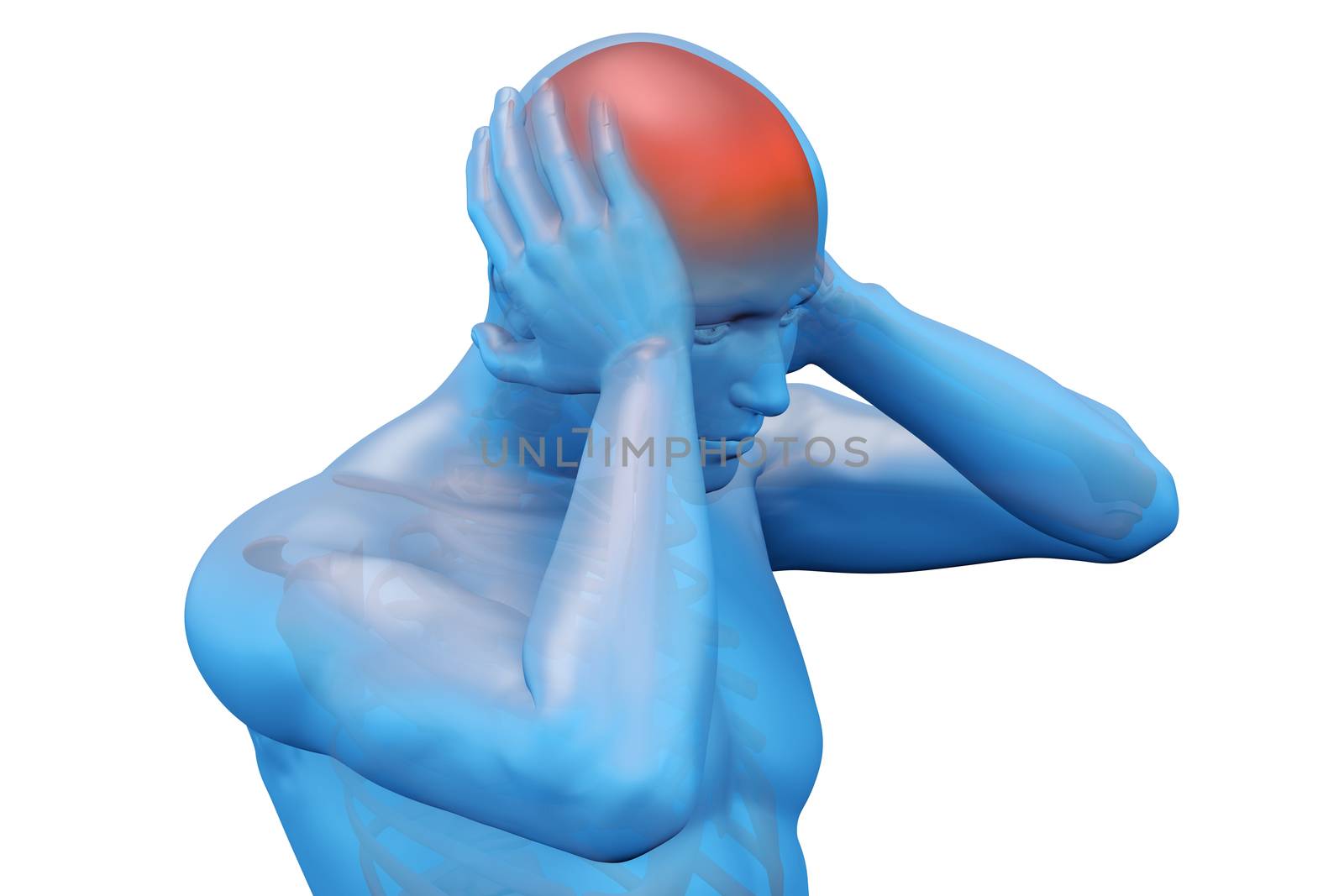 Digital illustration of a headache