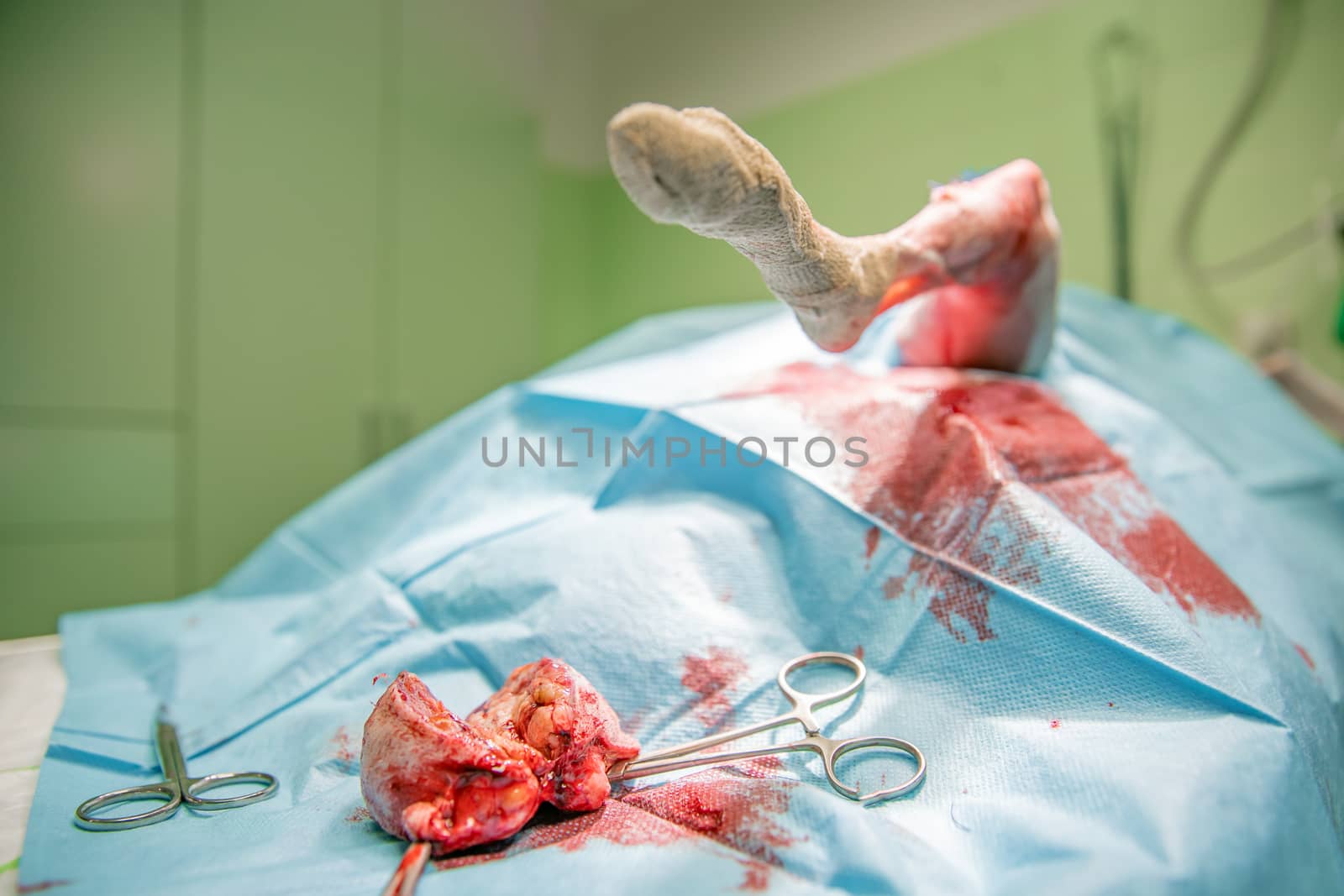 removal of benign tumor on the dog's paw by surgery.