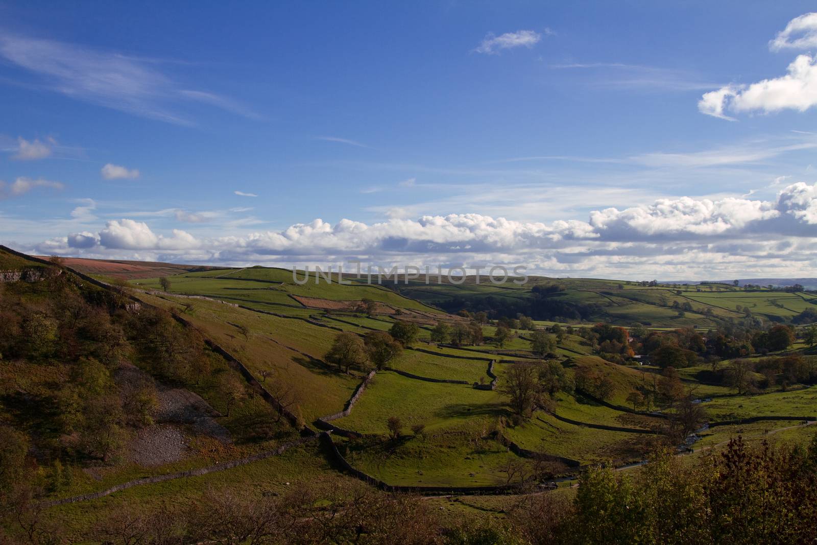 Malham Tarn Countryside by samULvisuals