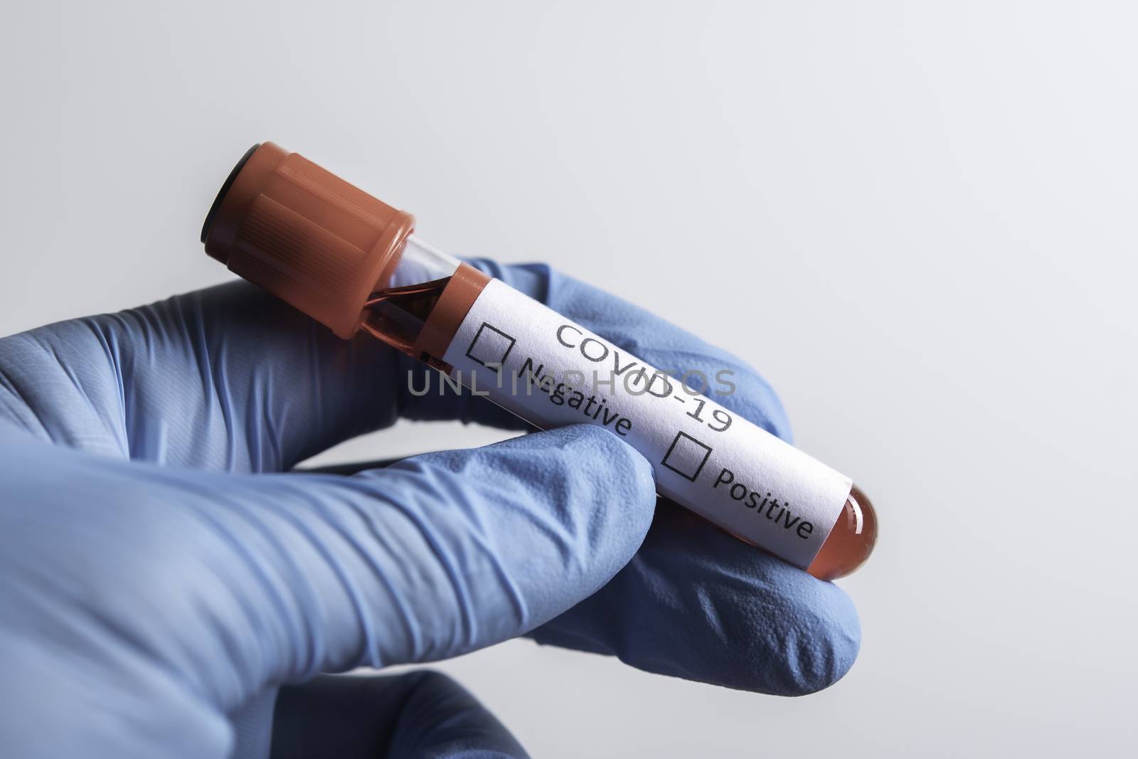 Blood sample tube positive with COVID-19 virus or novel coronavirus 2019 found in Wuhan, China