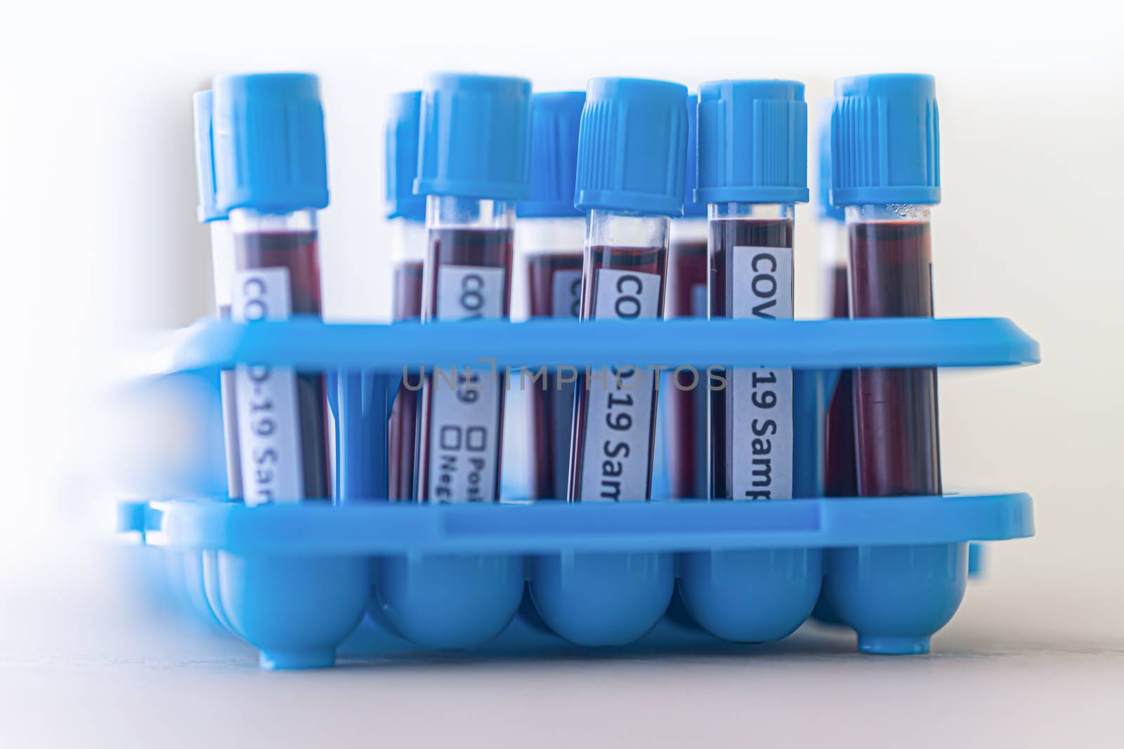 test tube with blood for 2019-nCoV analyzing. Novel  covid19 blood test Concept.