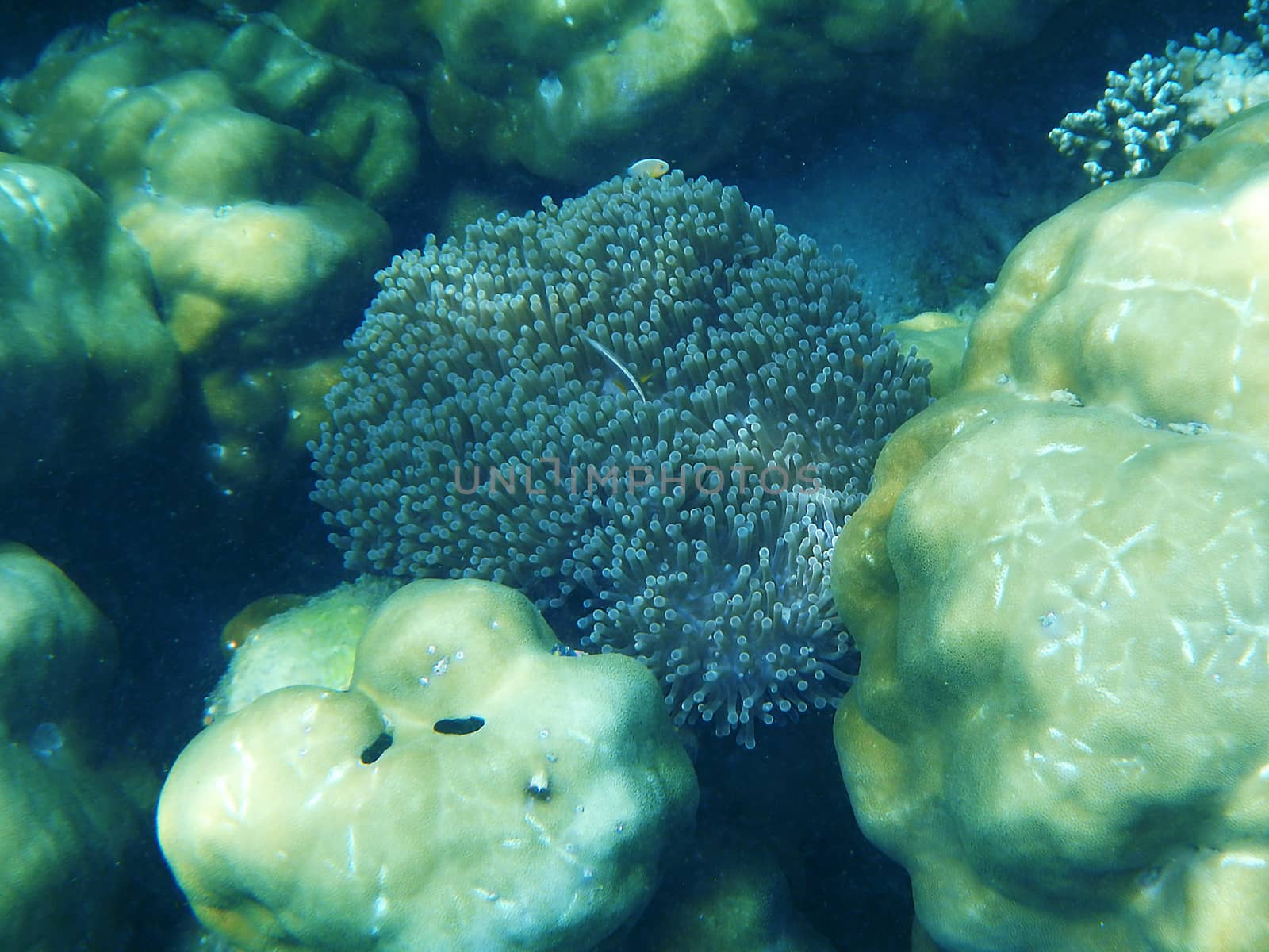 The Sea Anemones under the sea are invertebrates.