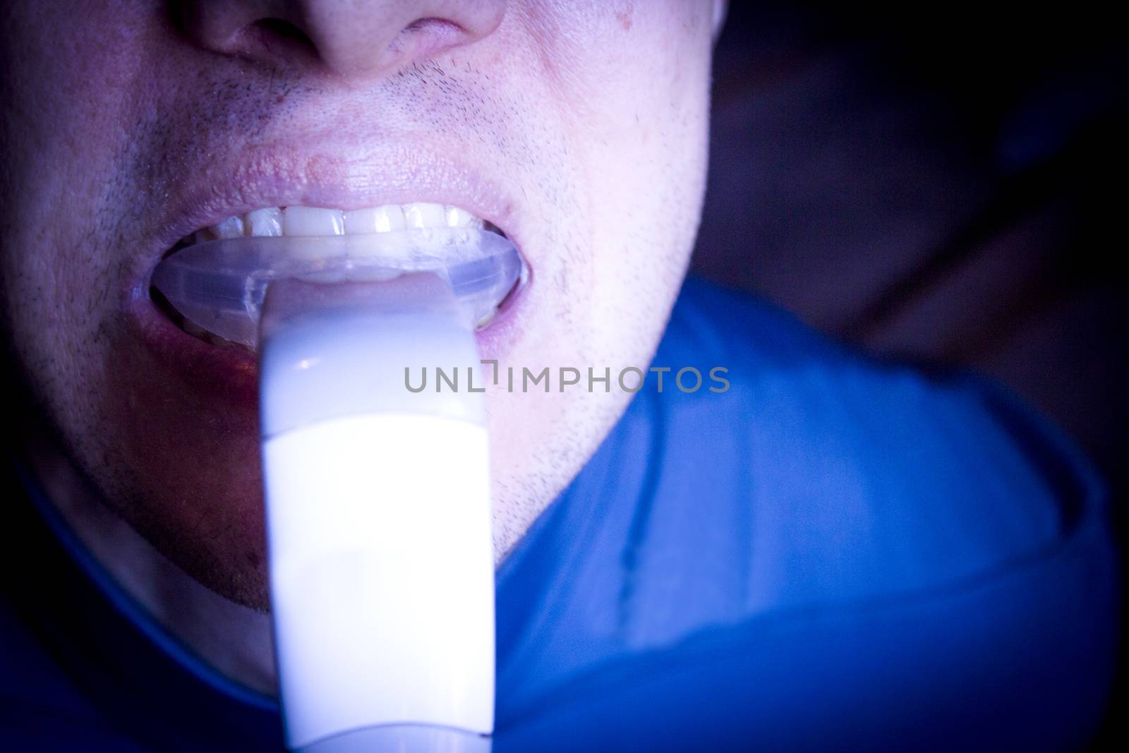 Vibrator for dental braces inside the mouth of a man