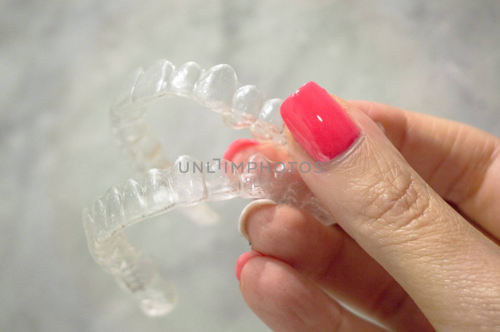 Invisible dental retainer held by womans hand by GemaIbarra